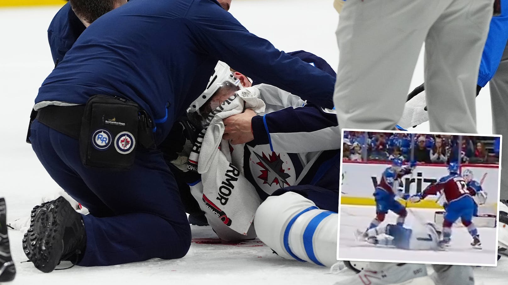 Schwerer Unfall! Puck trifft NHL-Profi im Gesicht