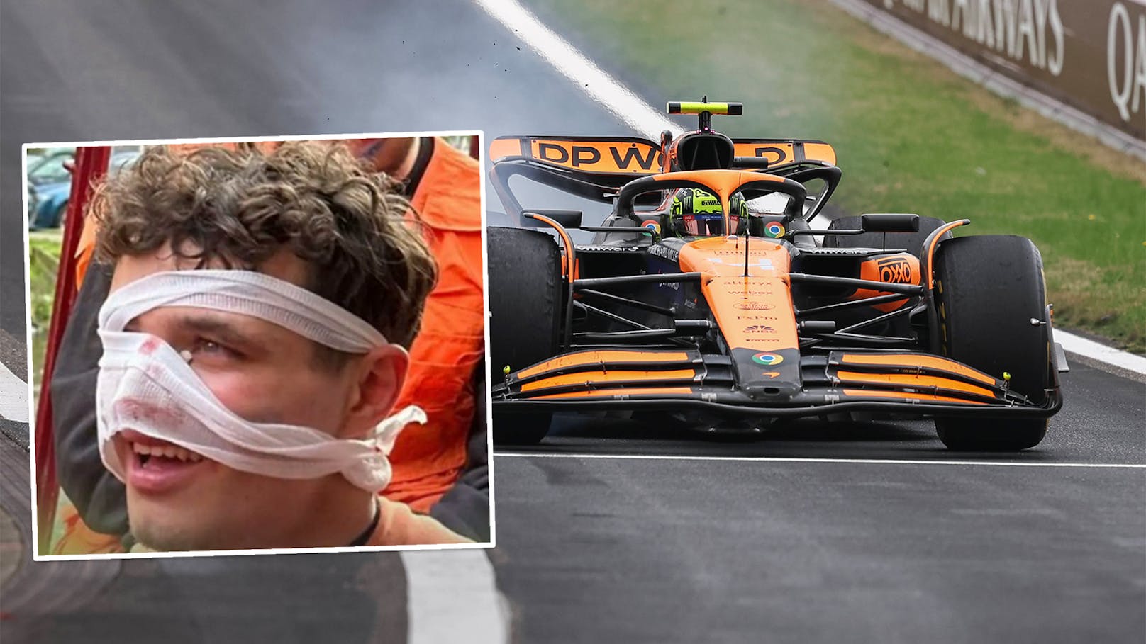 Schnittwunde im Gesicht! F1-Star Norris schockt Fans