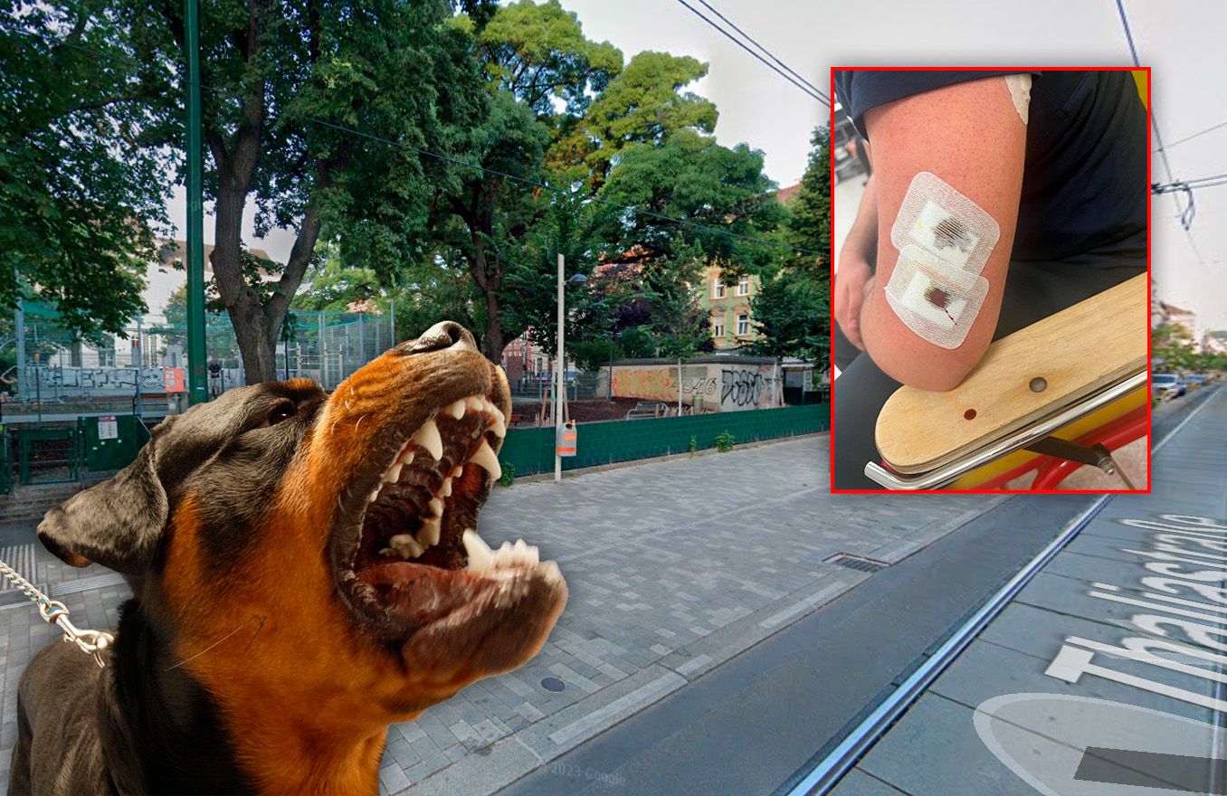 Ein Rottweiler biss den Wiener - sein Frauchen wird dafür nicht belangt. 