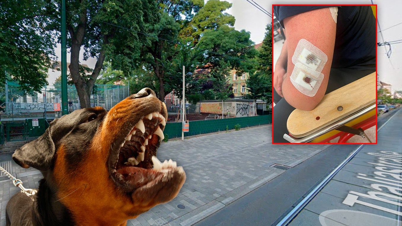 Heute.at - Listenhund beißt Teenie – Frauchen bleibt straffrei