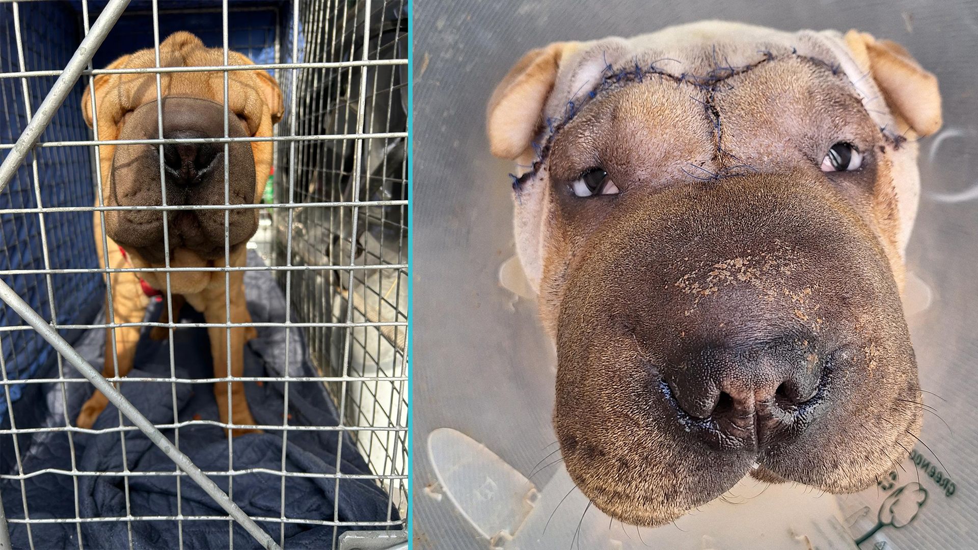 Die erste Operation hat 