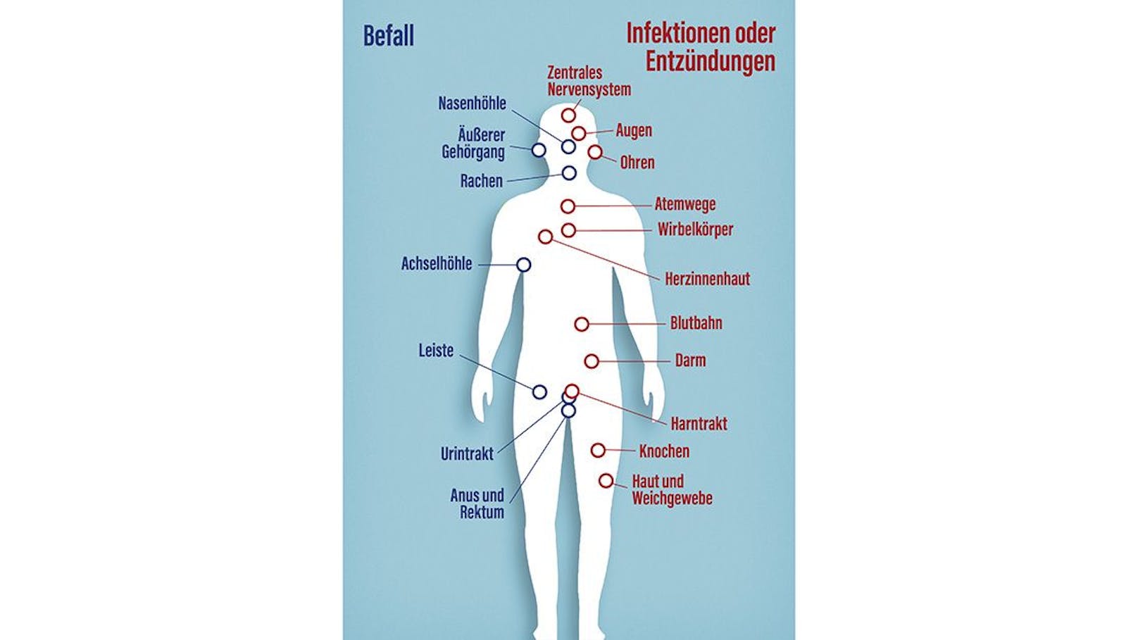 Von der Blutbahn aus kann der Hefepilz Candida auris das zentrale Nervensystem, Organe, Knochen und die Augen befallen.