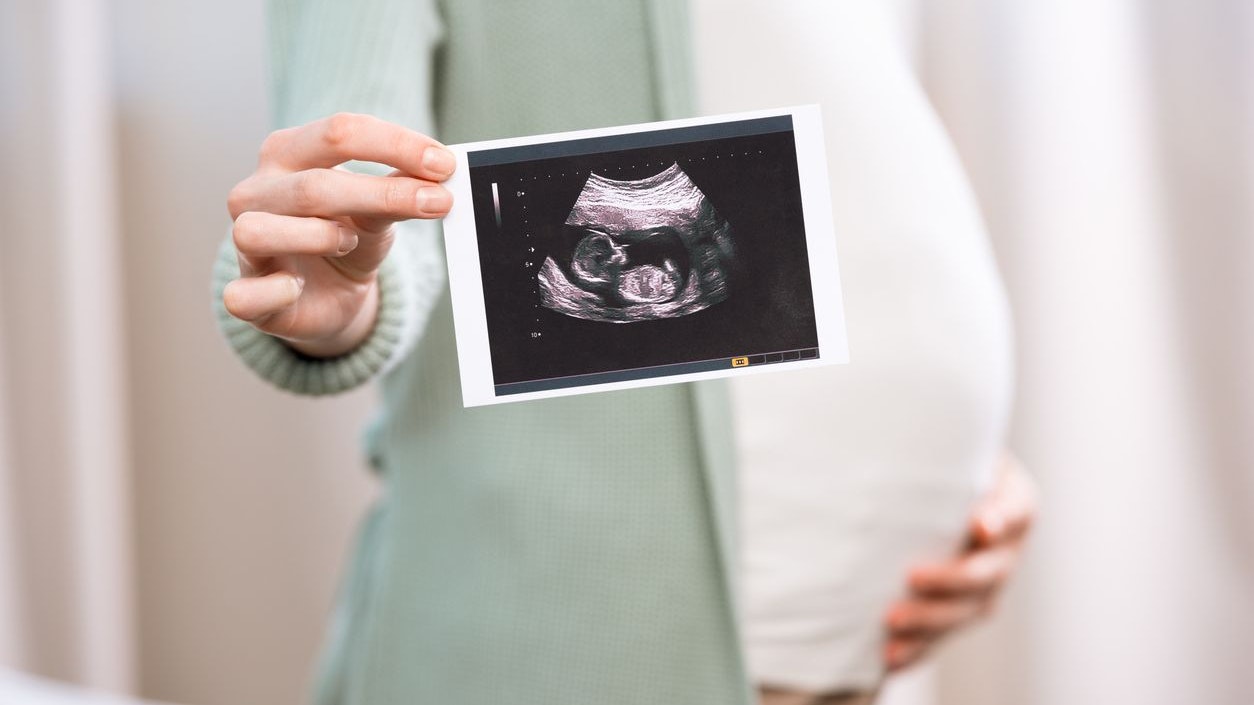 Pregnant woman holding ultrasound scan of baby and touching belly