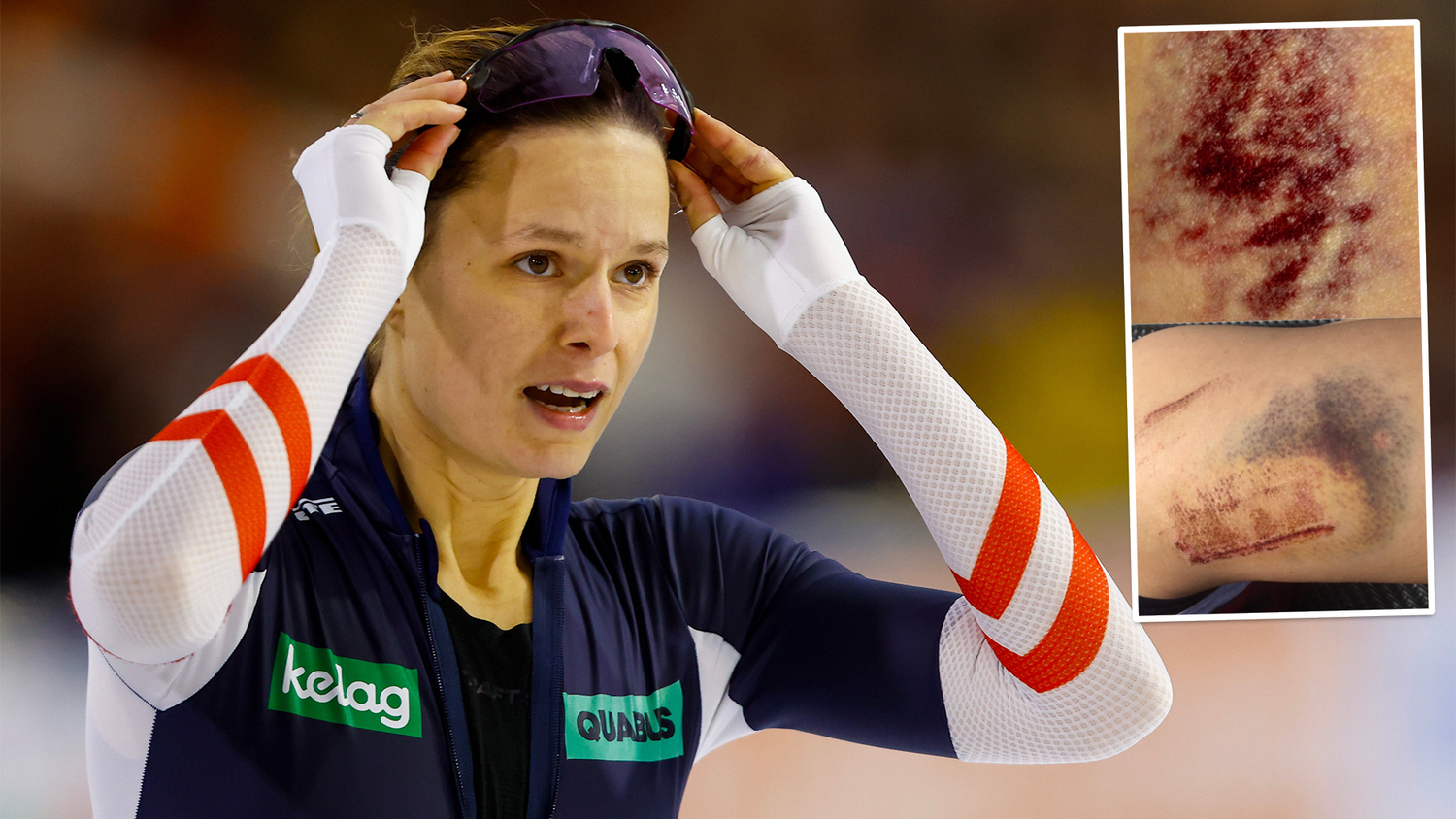 Vanessa Herzog hatte Glück – wie ihre Verletzungen zeigen.