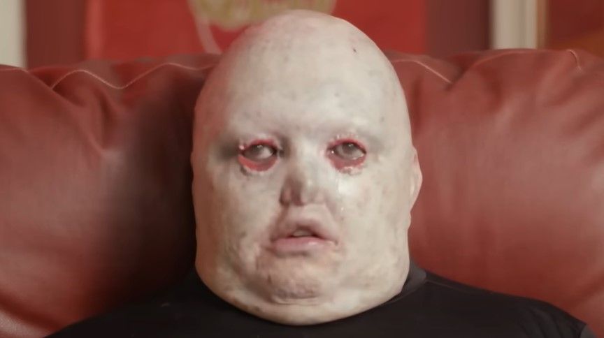 Dean Clifford (Bild) hat – entgegen der Prognose seiner Ärzte – überlebt und setzt sich heute für Behinderte ein.