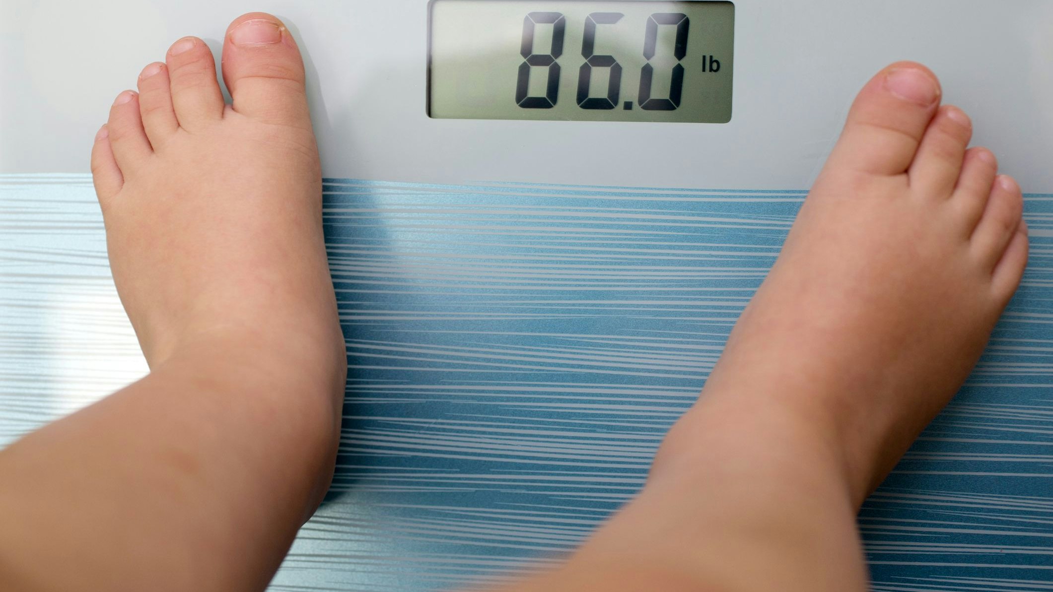 Fettleibigkeit unter Jugendlichen gehört heute zu den am weitesten verbreiteten Zivilisationskrankheiten