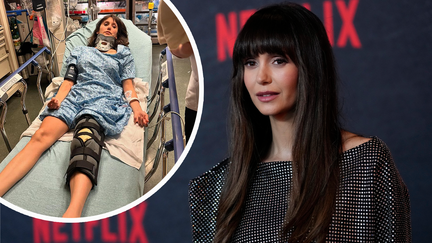 "The Vampire Diaries"-Star Nina Dobrev ist nach einem schweren Unfall mit ihrem E-Bike ins Krankenhaus eingeliefert worden.