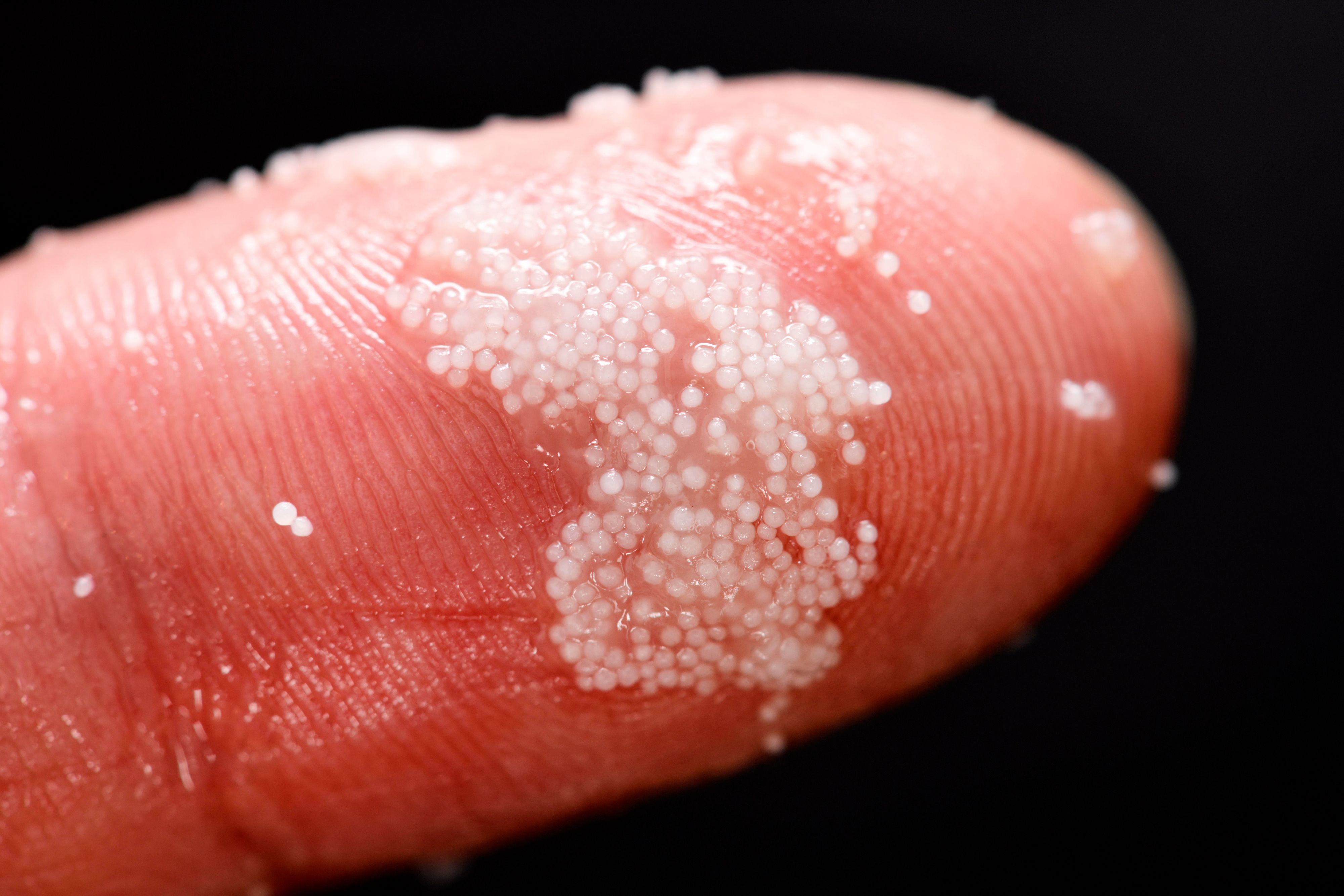 Mikroplastik ist allgegenwärtig – und meist von bloßem Auge nicht sichtbar.