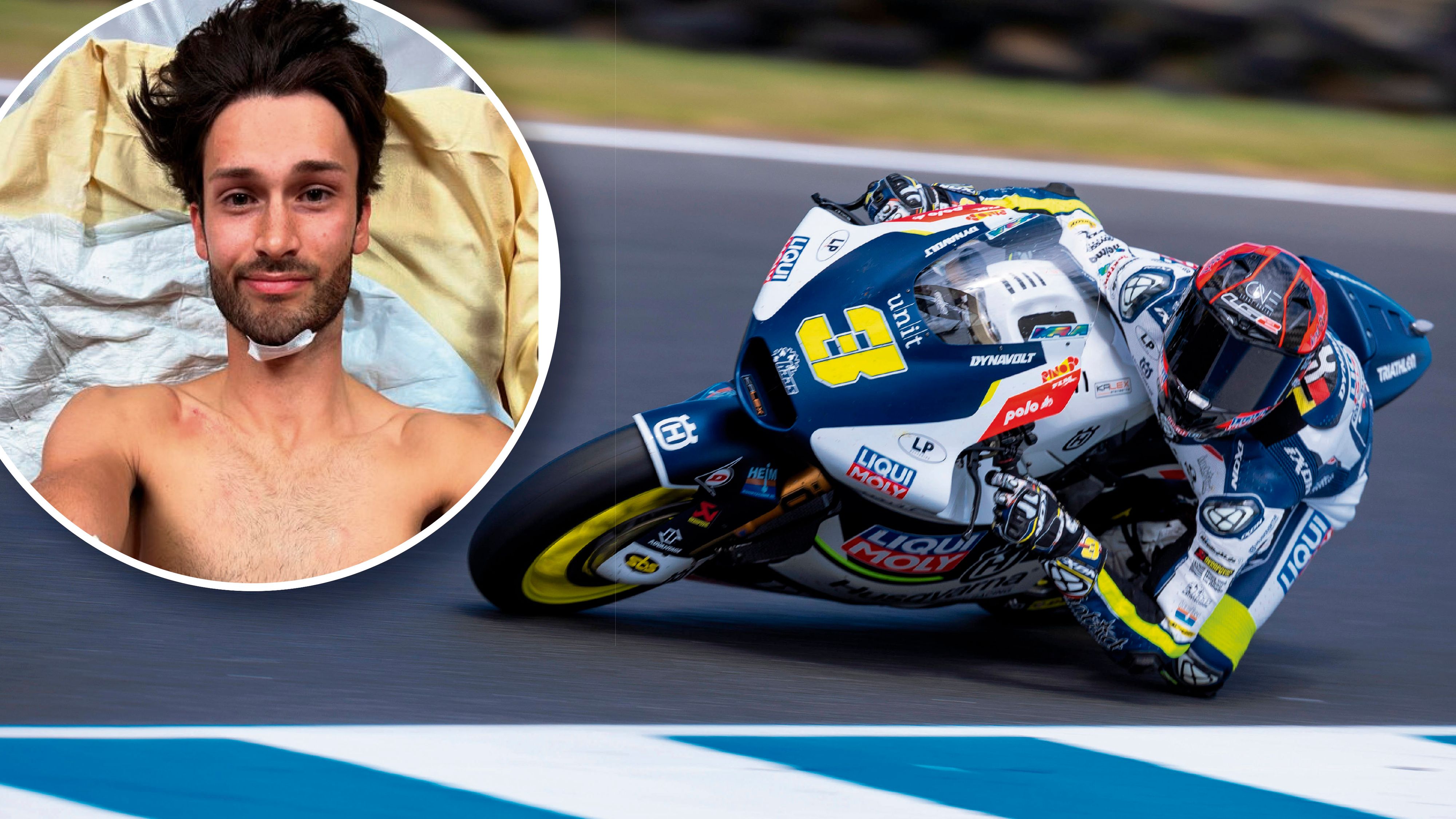 Motorrad-Pilot Tulovic mit genähtem Kinn