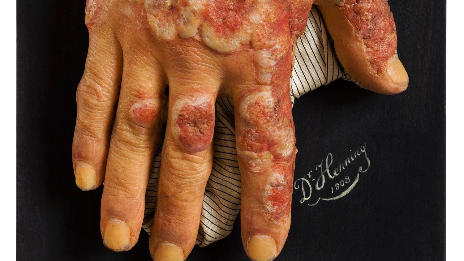 Appetitlich sind die Abbildungen zwar nicht, aber spannend.