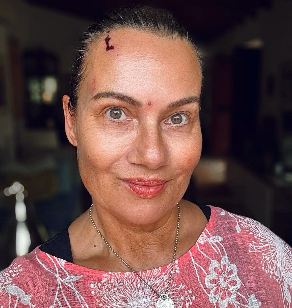 Jenny Jürgens erholt sich in ihrer Wahlheimat Mallorca von der Krankheit 