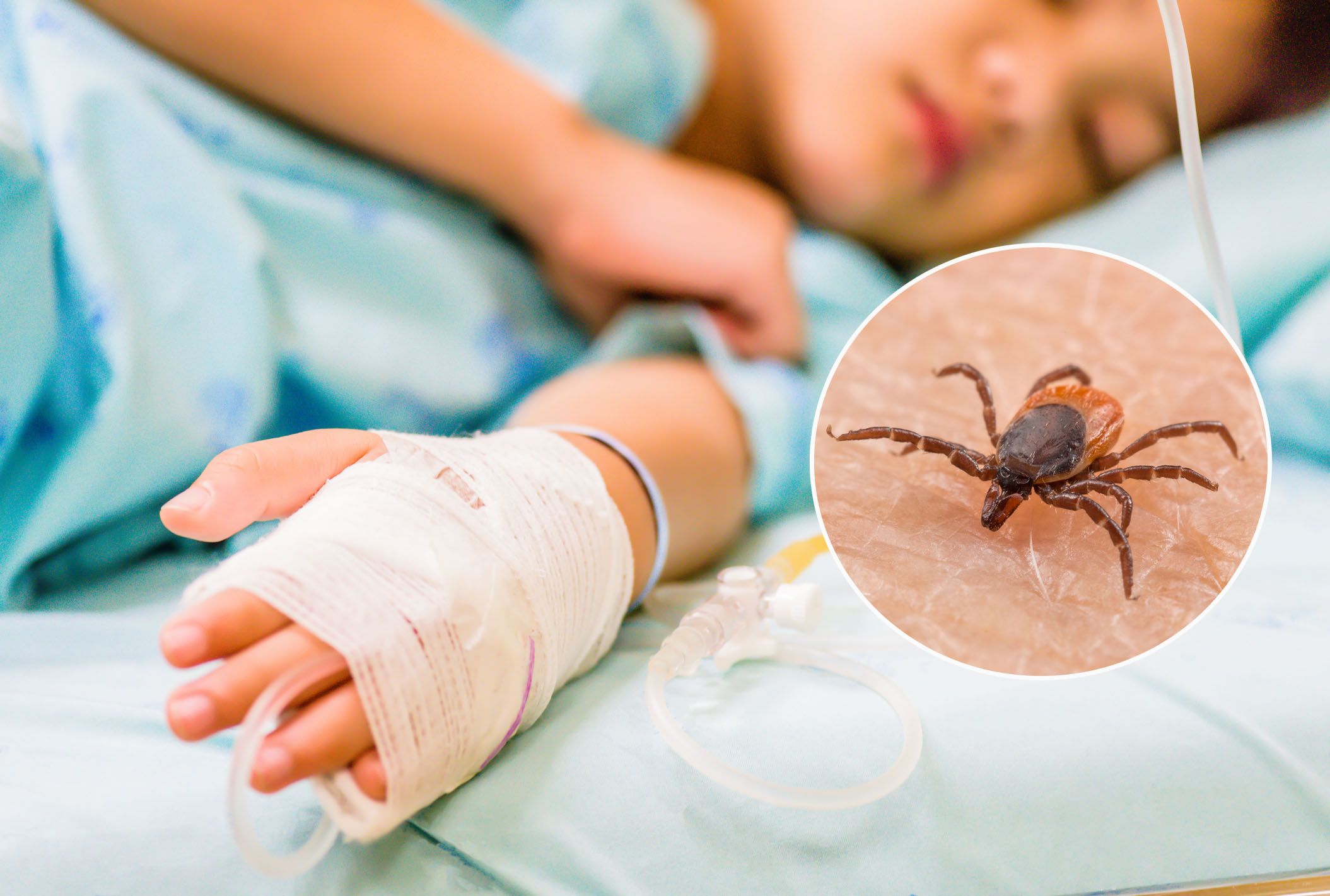 Der Bub lag mit einer Gehirnhautentzündung auf der Intensivstation (Symbolbild).