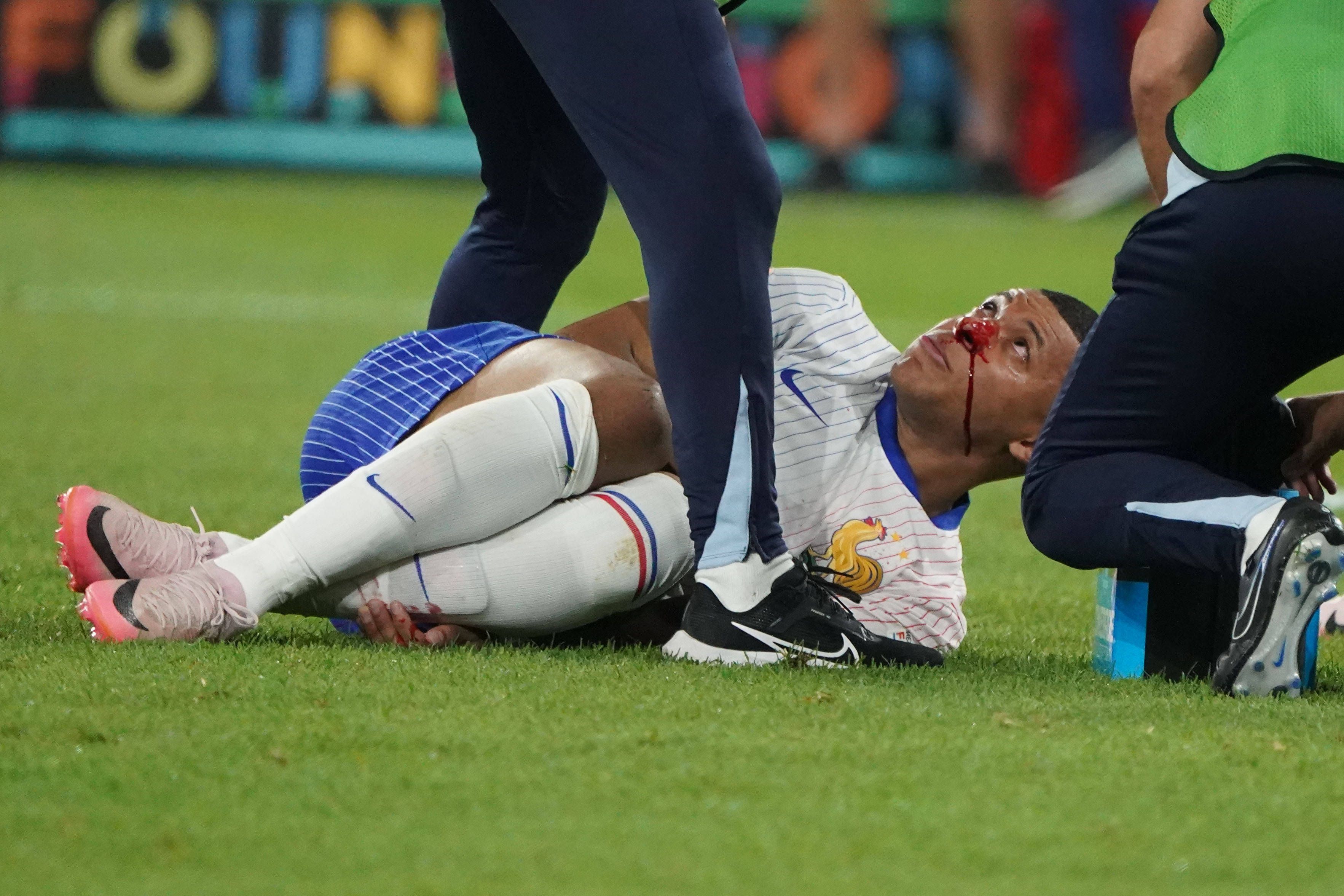 Mbappe brach sich gegen Danso womöglich die Nase.