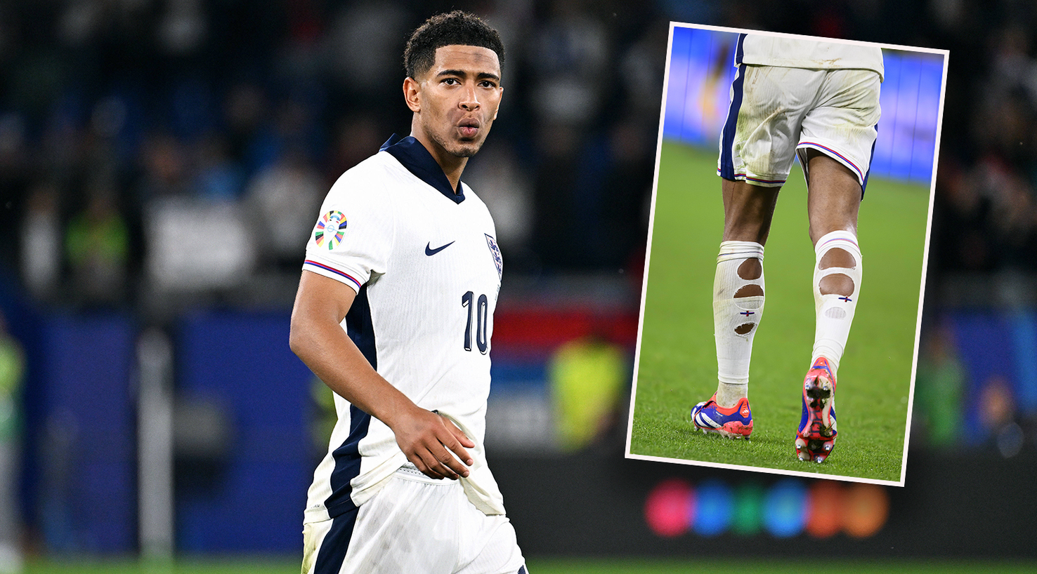 England-Star Jude Bellingham spielt mit Löchern in den Stutzen. 