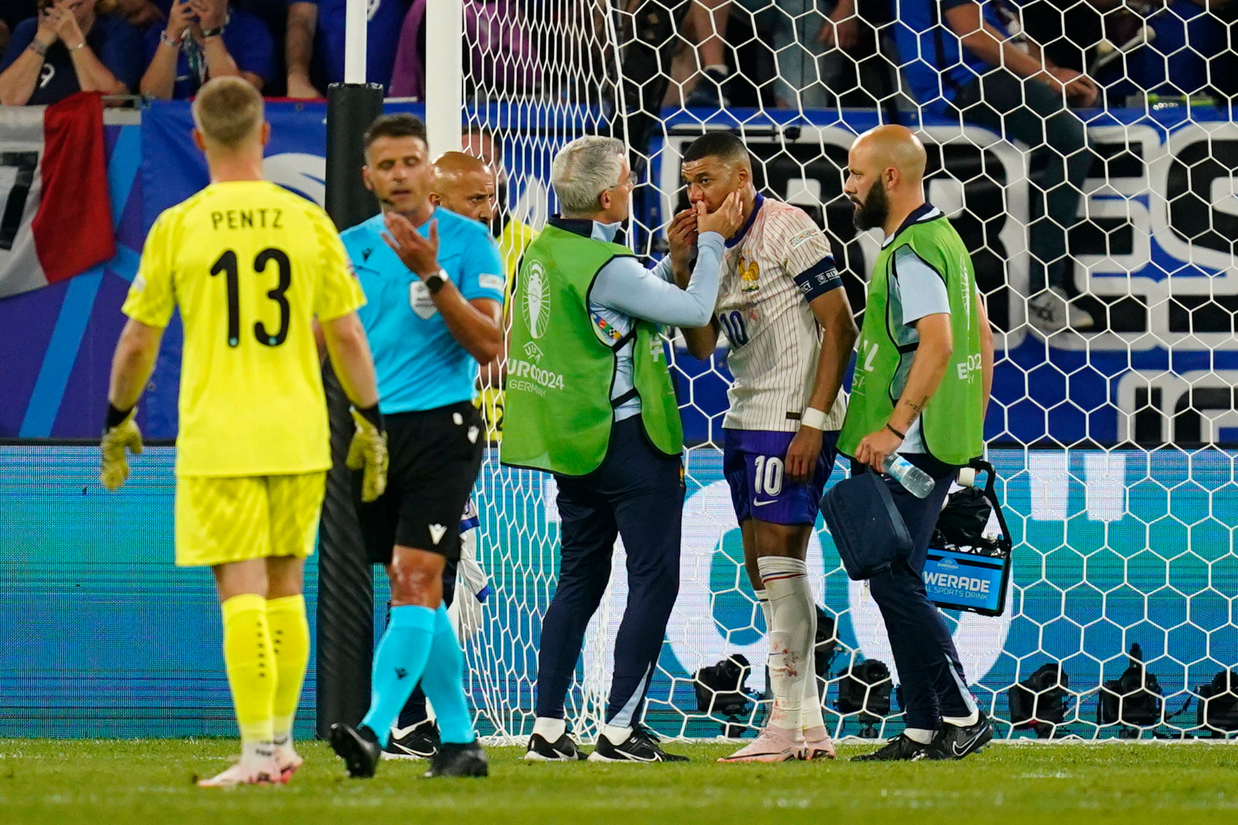 Kylian Mbappe verletzte sich in einem Duell mit Kevin Danso im Gesicht.
