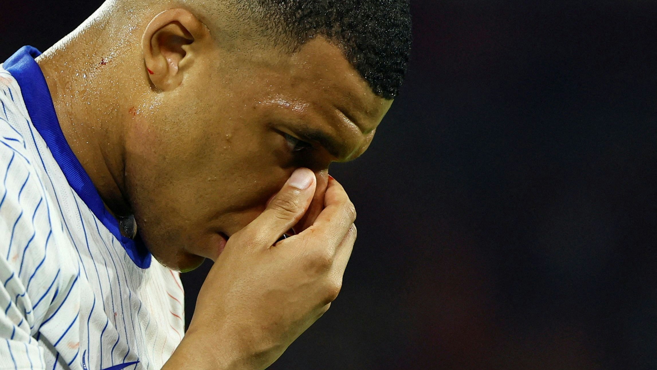 Fußball-Star Kylian Mbappe hat sich gegen Österreich die Nase gebrochen. 