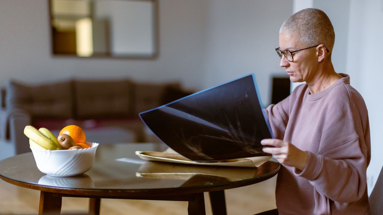 Living with cancer. Woman examining her chest x-ray at home