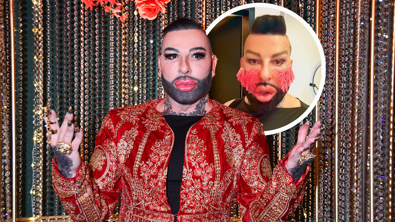 Ein weiterer Beauty-Eingriff für Harald Glööckler.