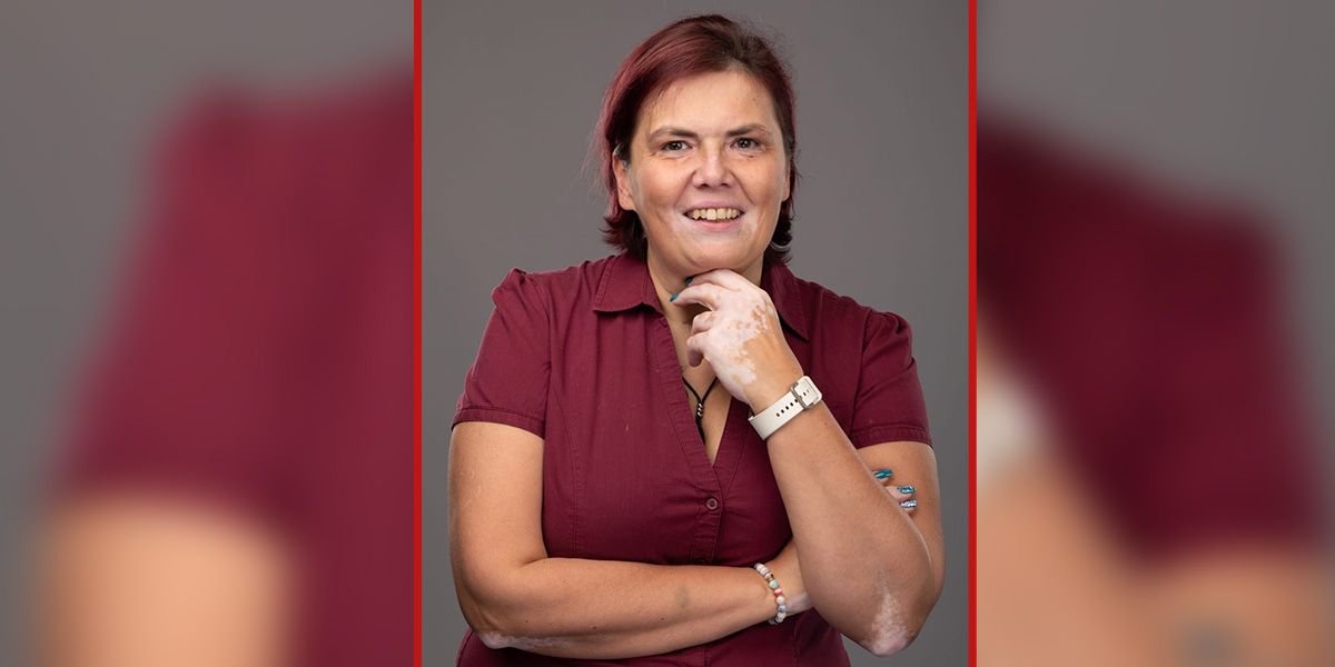 Annette-Marie (Bild) hat sich mit ihrer Erkrankung arrangiert und möchte für andere Betroffene da sein.