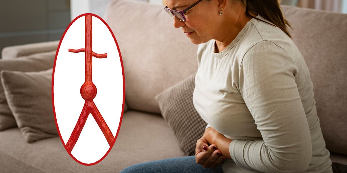 Ein Aneurysma verursacht in den meisten Fällen lange Zeit keine Beschwerden.