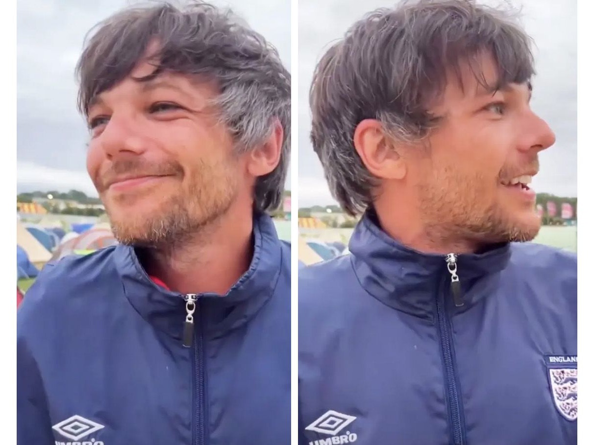 Louis Tomlinson hat graue Haare.