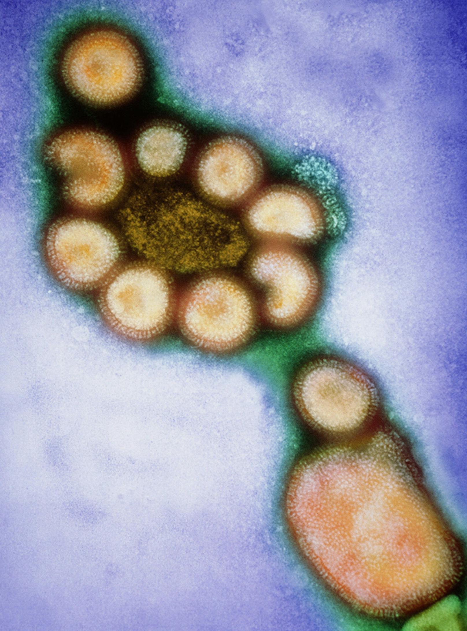 Die <strong>Asiatische Grippe</strong> war nach der Spanischen Grippe die zweitschlimmste Influenza-Pandemie des 20. Jahrhunderts. Sie wurde <strong>1957</strong> durch das Influenzavirus A/Singapore/1/57 ausgelöst und hatte ihren Ursprung vermutlich in der Volksrepublik China. Ihr fielen weltweit Schätzungen zufolge eine bis zwei Millionen Menschen zum Opfer