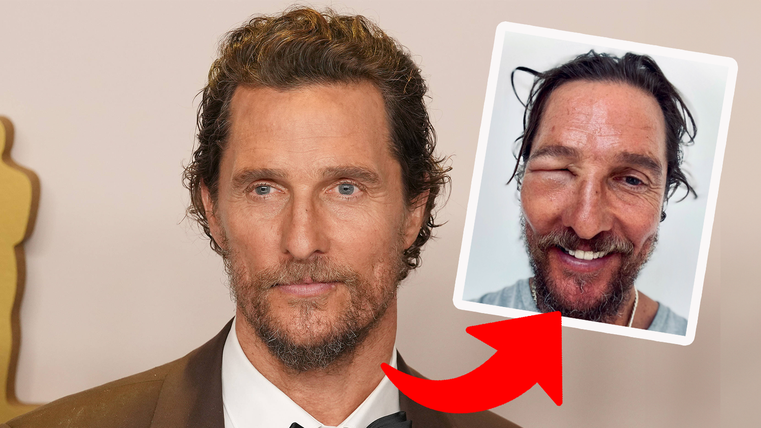 Matthew McConaughey hat offenbar mit einer eingeschränkten Sicht zu kämpfen.