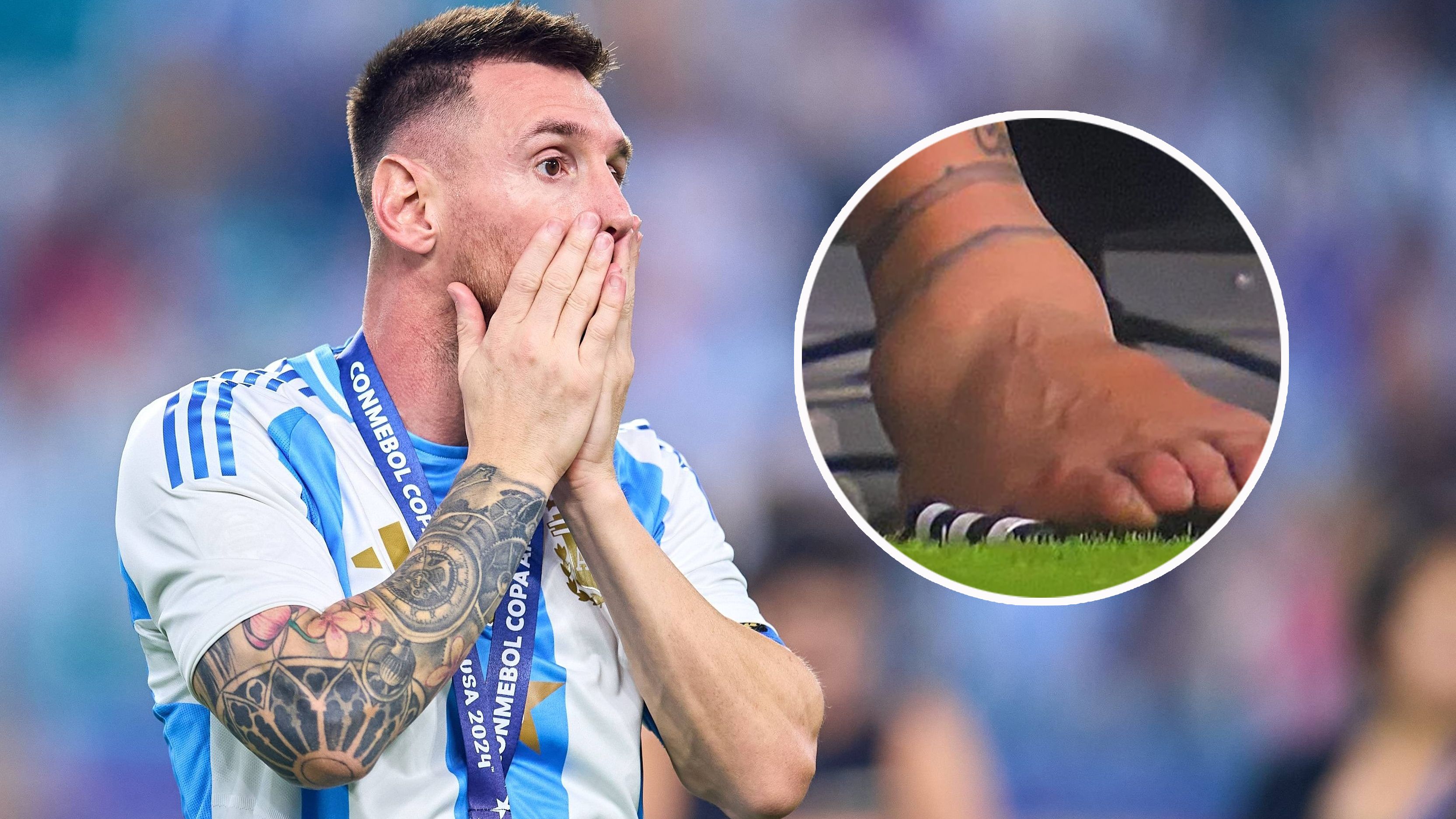 Lionel Messis Knöchel nach der Verletzung im Copa-Finale.