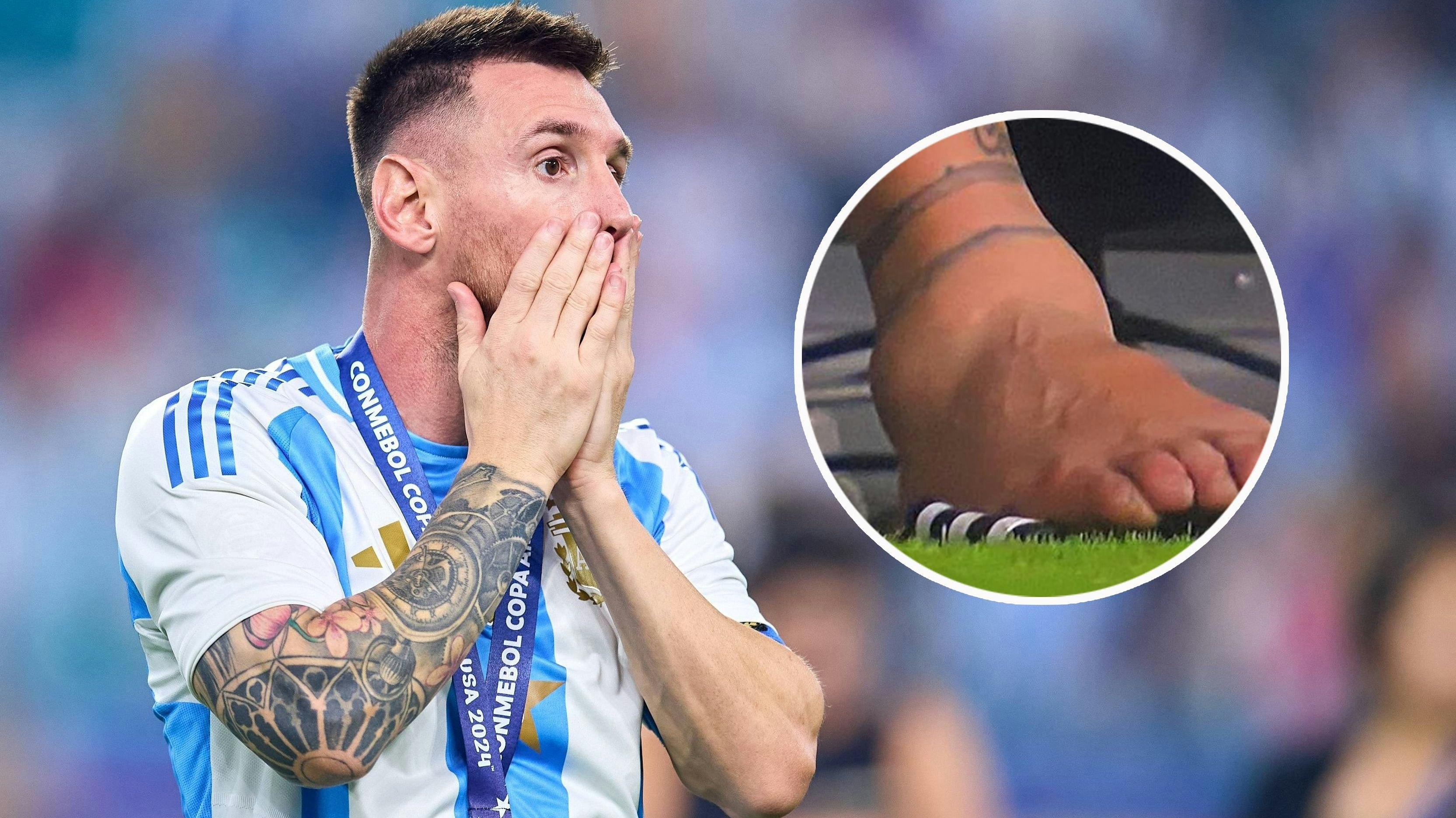 Lionel Messis Knöchel nach der Verletzung im Copa-Finale.