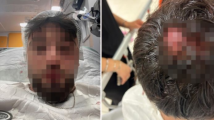 Mit Verletzungen am Kopf und Oberkörper musste der 18-Jährige hospitalisiert werden.