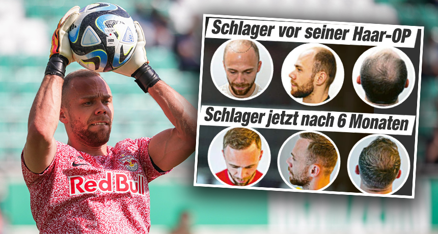 Alexander Schlager vor und nach seiner OP