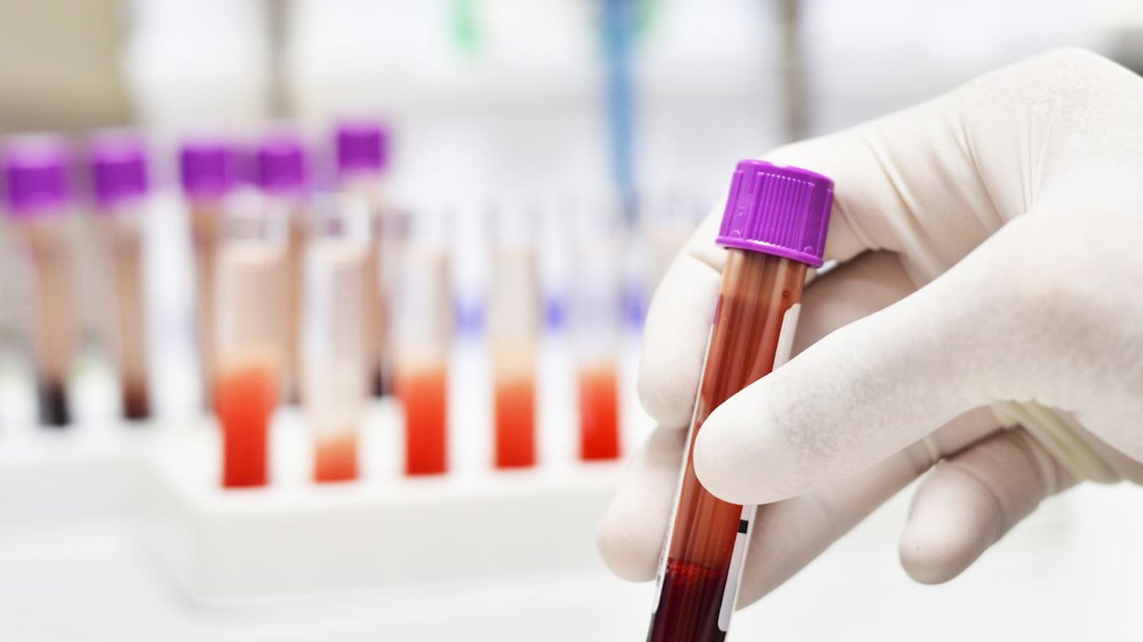 Bluttest könnte mehr als 60 Krankheiten vorhersagen