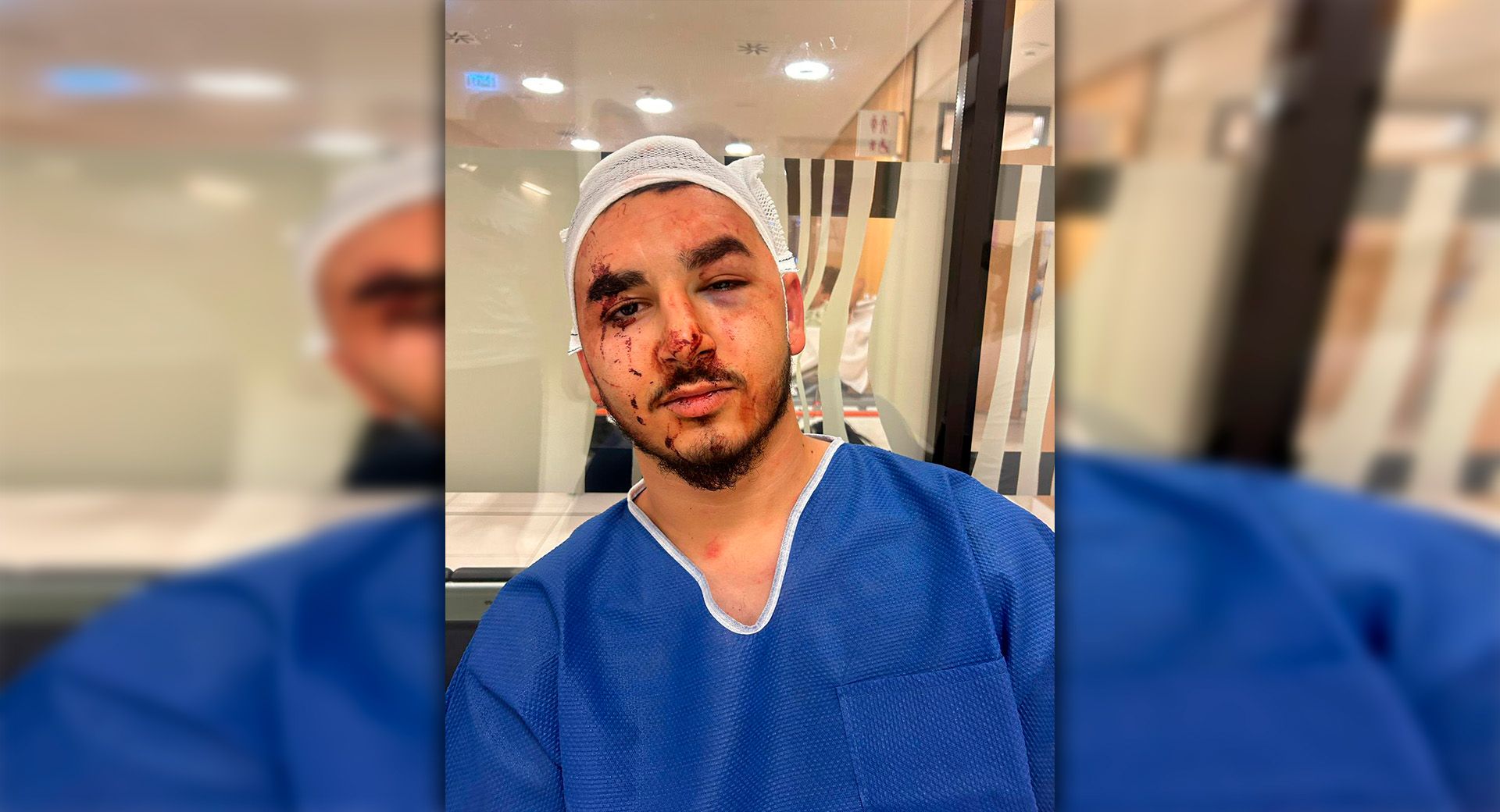 Onur (20) wurde von maskierten Männern attackiert. 