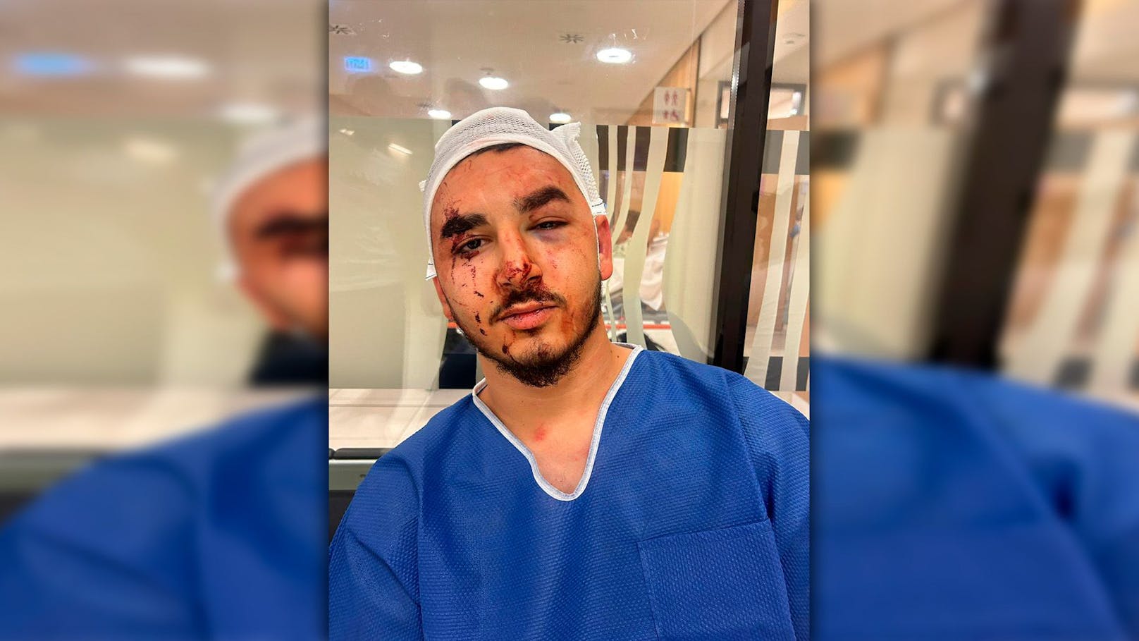 20-Jähriger brutal verprügelt, weil er Türkisch spricht