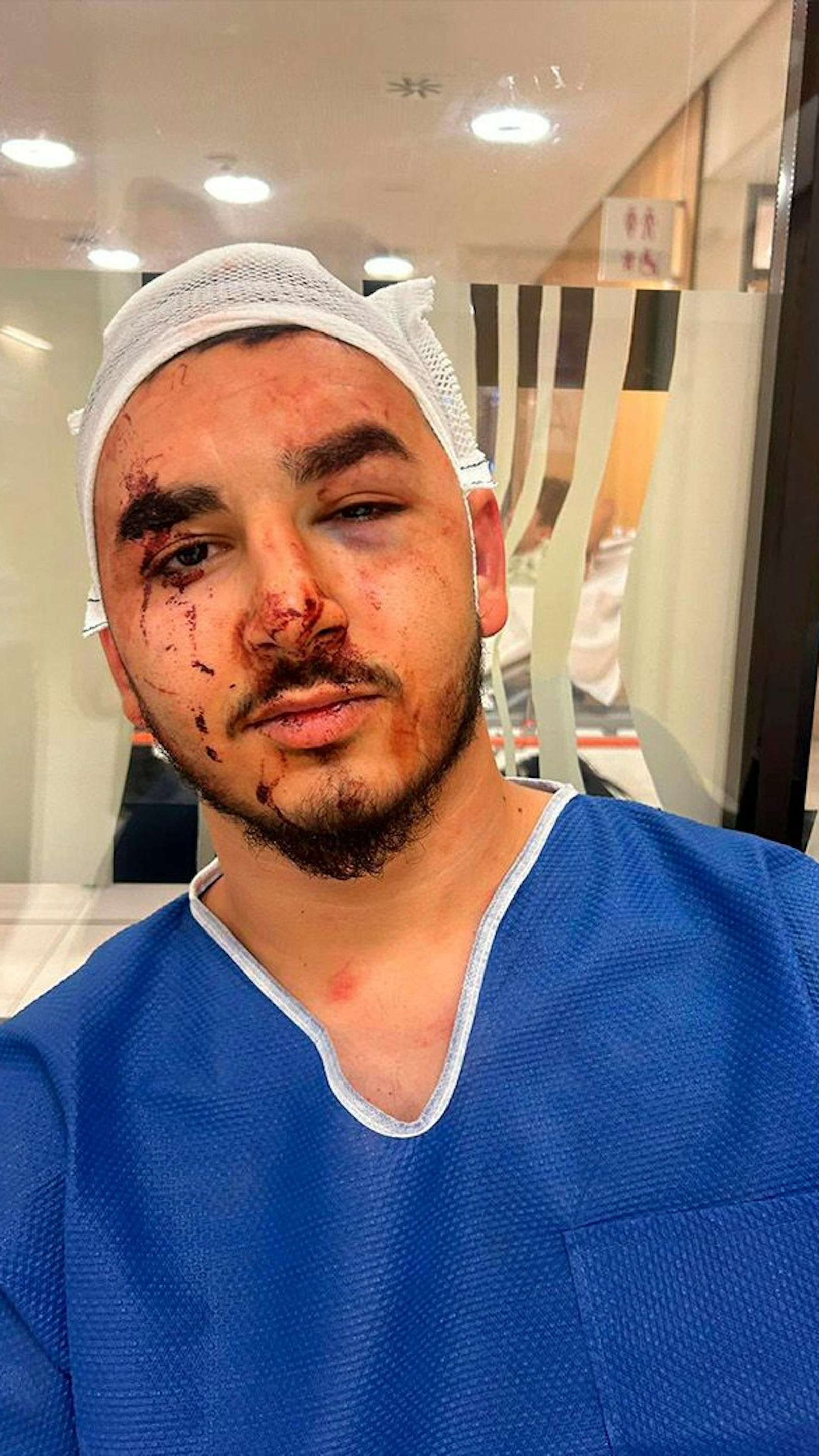 20-Jähriger brutal verprügelt, weil er Türkisch spricht