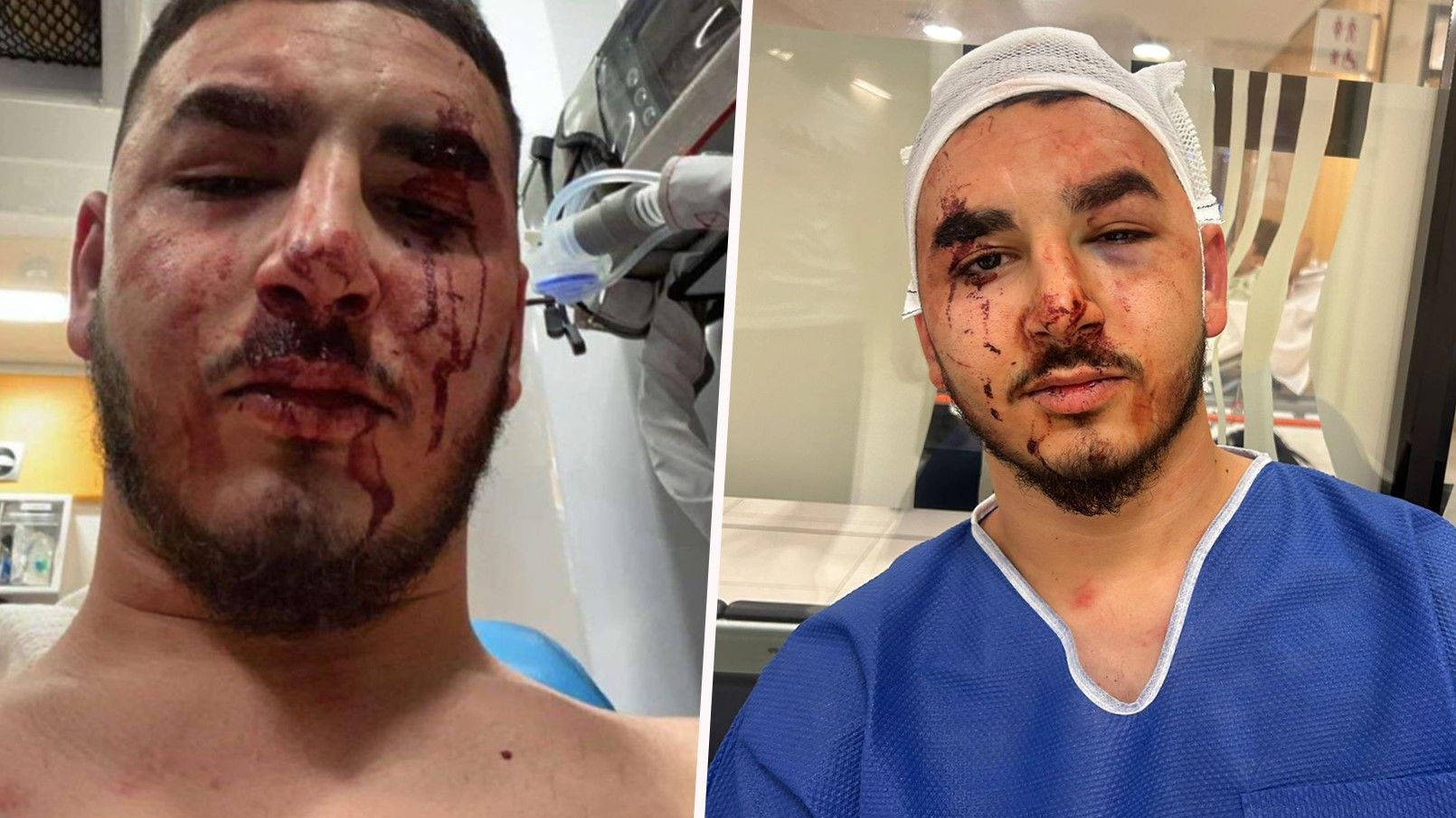 Unfassbare Gewalt-Tat von Vermummten in der Wiener Donaustadt!