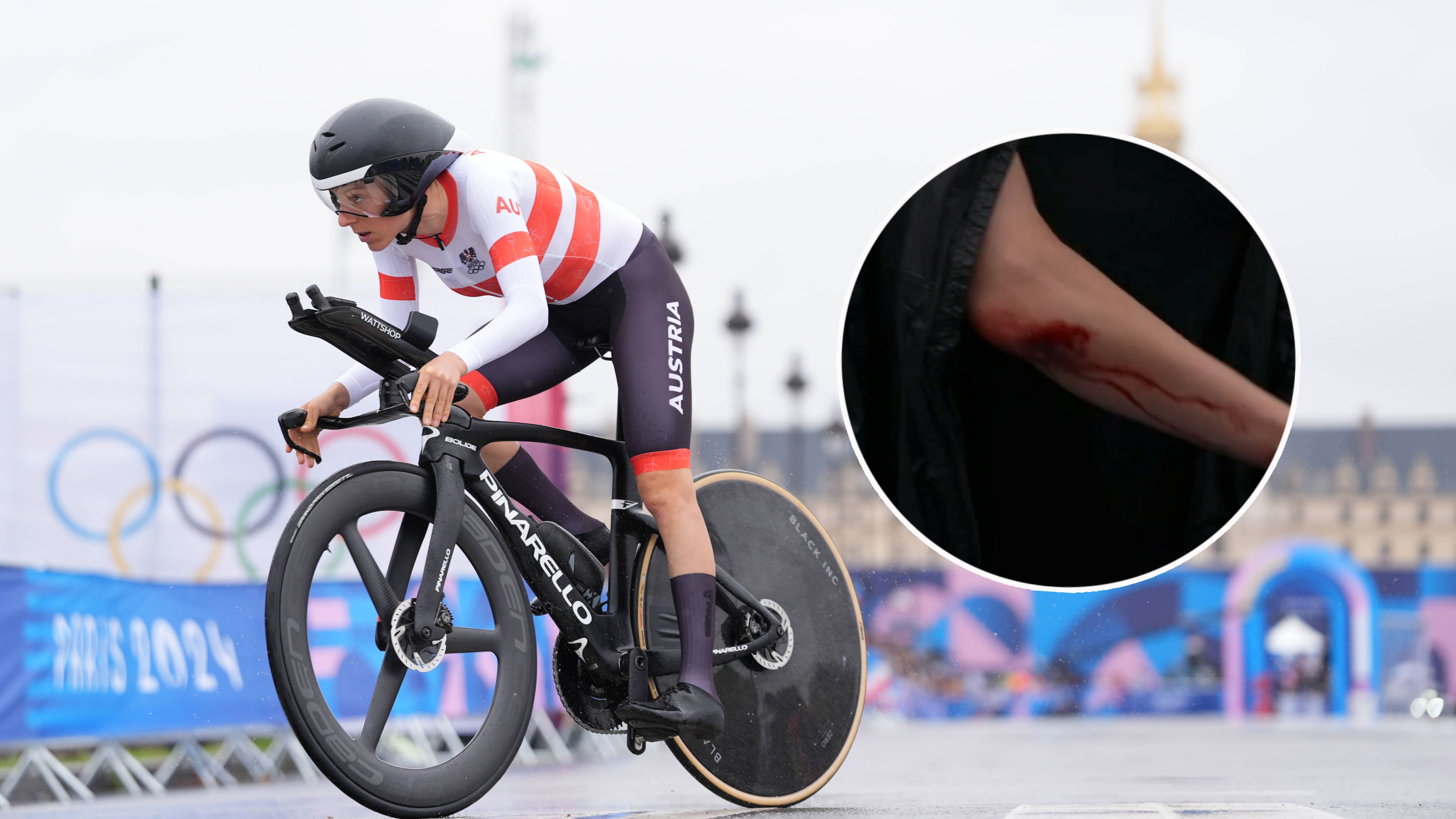 Anna Kiesenhofer verletzte sich beim Olympia-Sturz am Ellbogen.