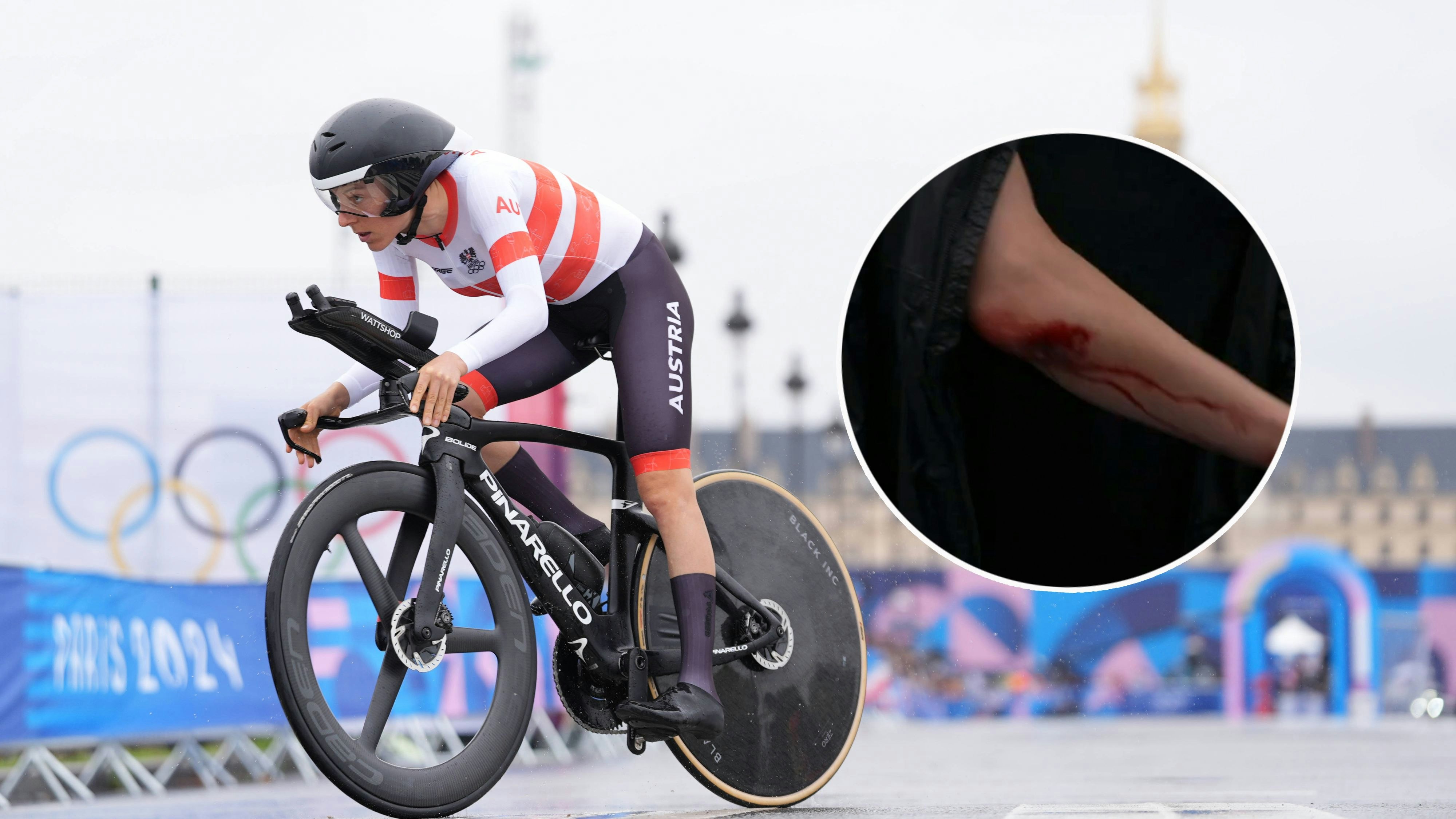 Anna Kiesenhofer verletzte sich beim Olympia-Sturz am Ellbogen.