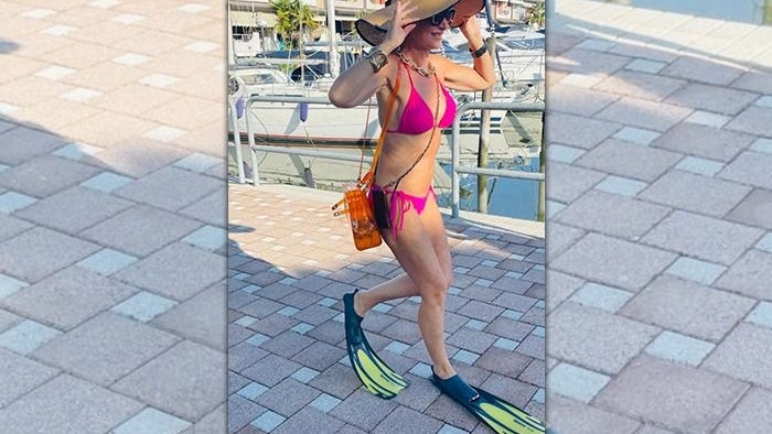 Christina "Mausi" Lugner war zu lange mit den Flossen schwimmen und zog sich so eine Fraktur zu.