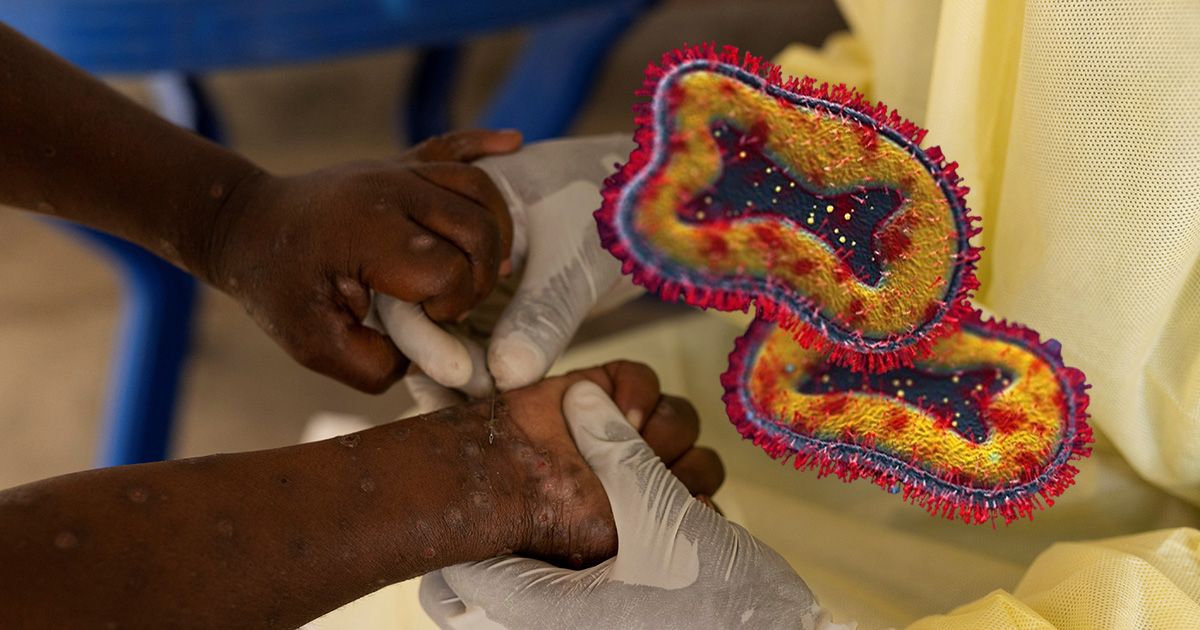 Die neue Virusvariante verbreitet sich vor allem unter Kindern schnell, für die eine Infektion lebensbedrohlich ist.