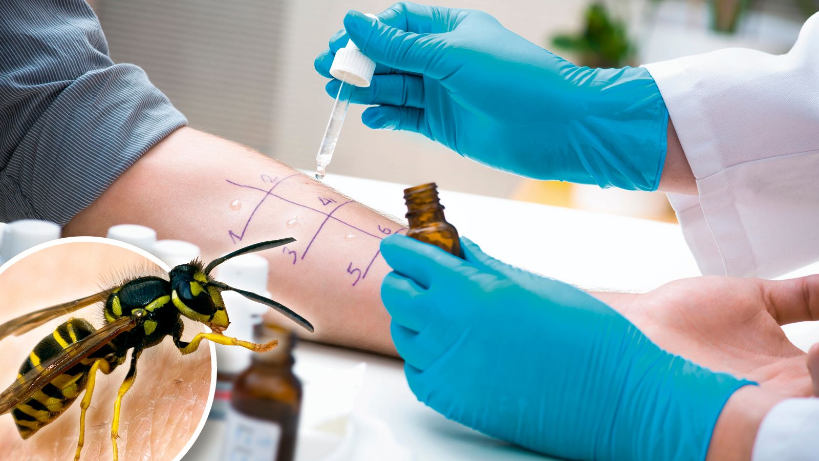 Schon vor dem ersten Stich ist ein Allergie-Test ratsam. Für den Ernstfall sollten Betroffene jederzeit Medikamente dabei haben.