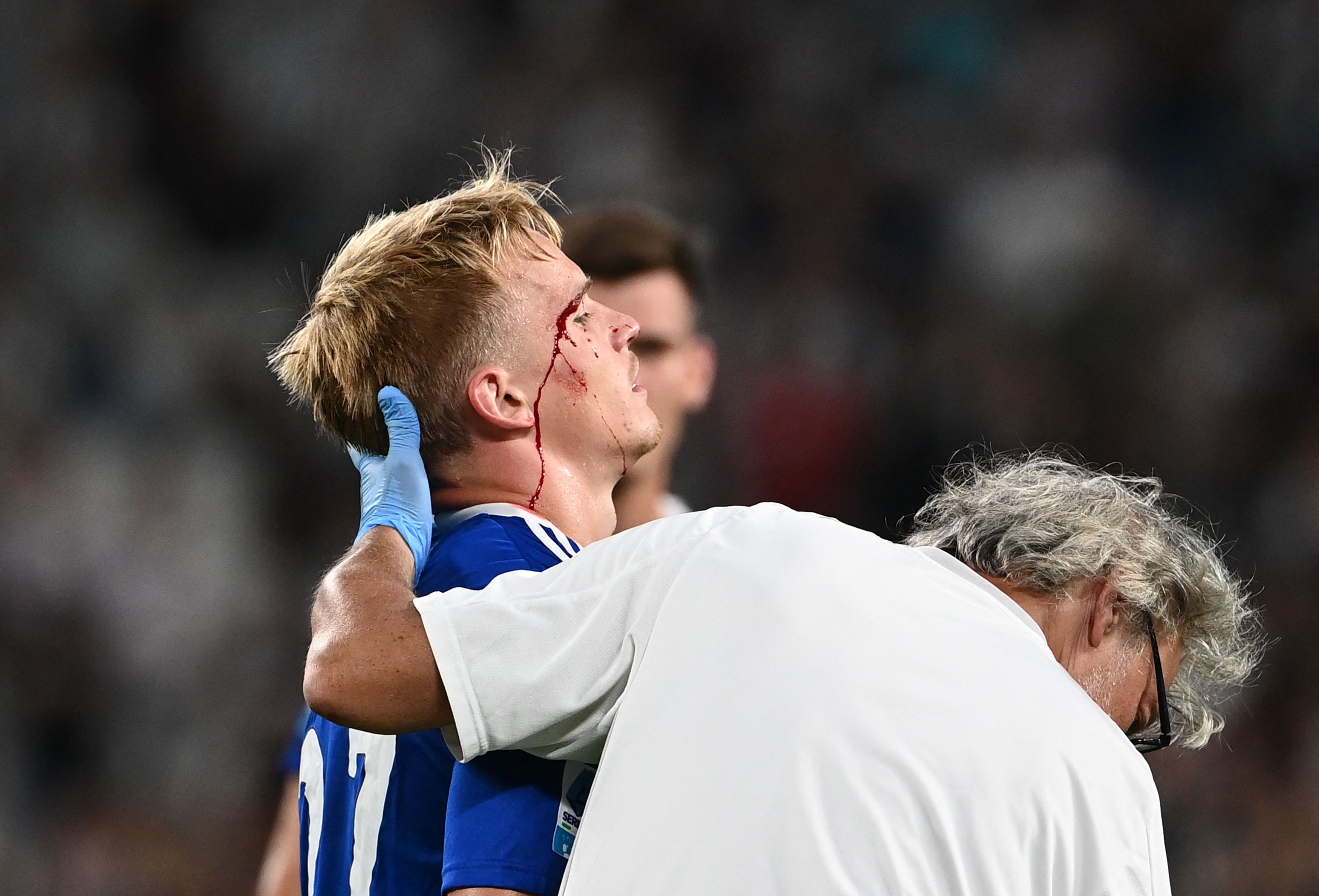 Matthias Braunöder erlitt bei seinem ersten Serie-A-Spiel eine Schnittwunde.