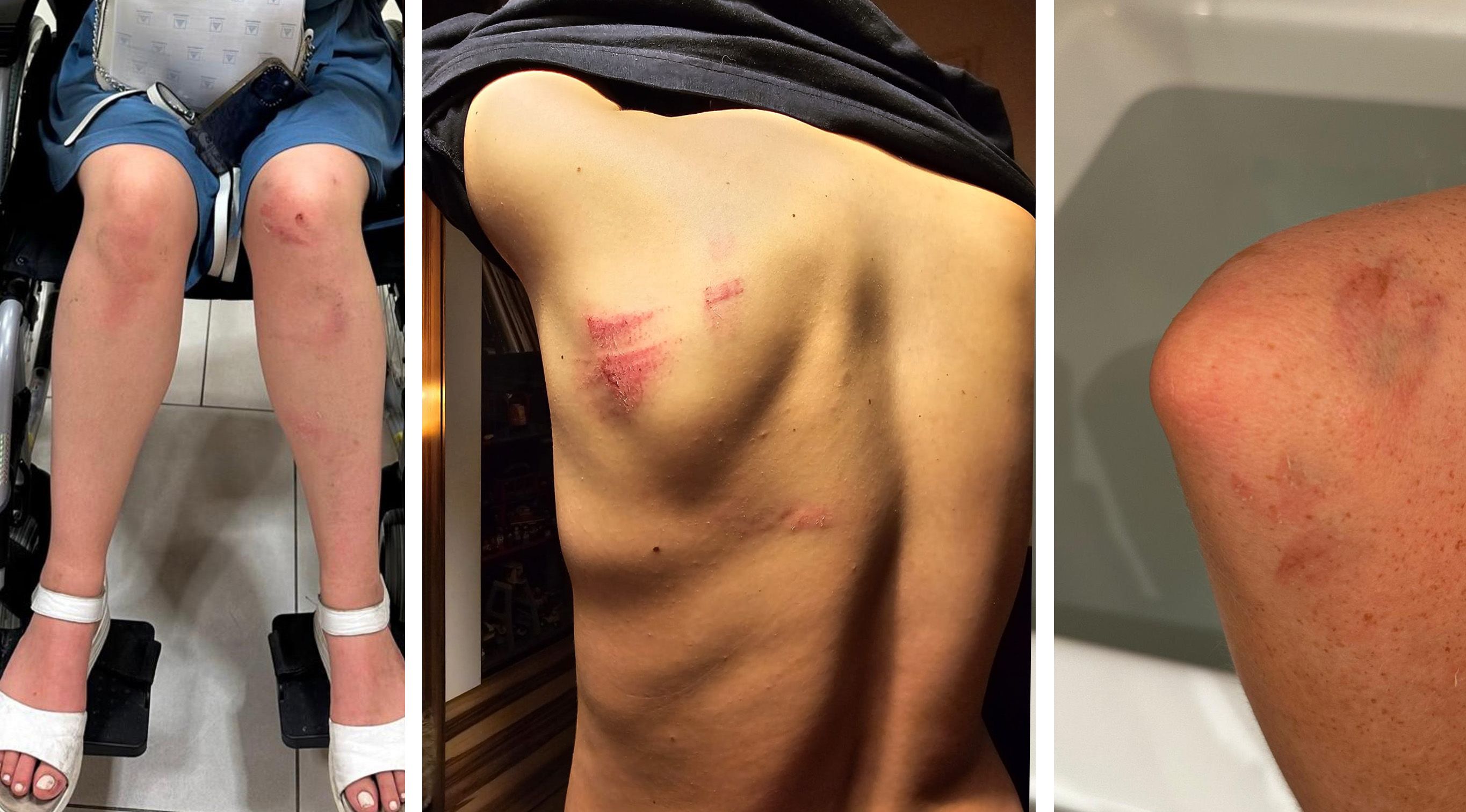 Mehrere Verletzte nach einer mutmaßlichen Attacke durch einen bekannten Heurigenwirt