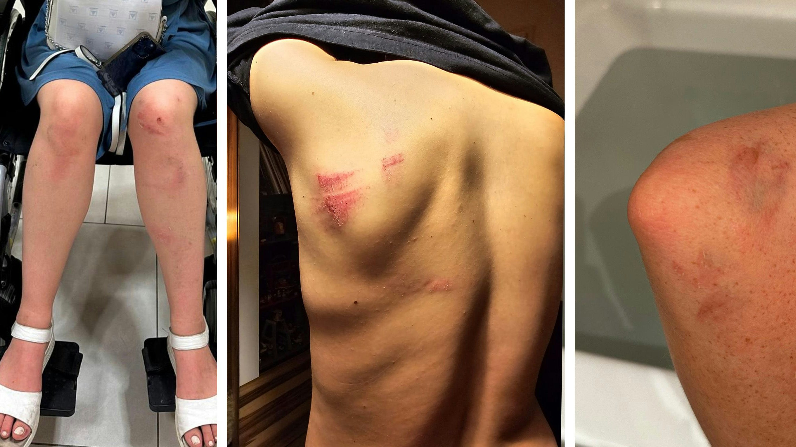 Mehrere Verletzten nach einer mutmaßlichen Attacke durch einen bekannten Heurigenwirt