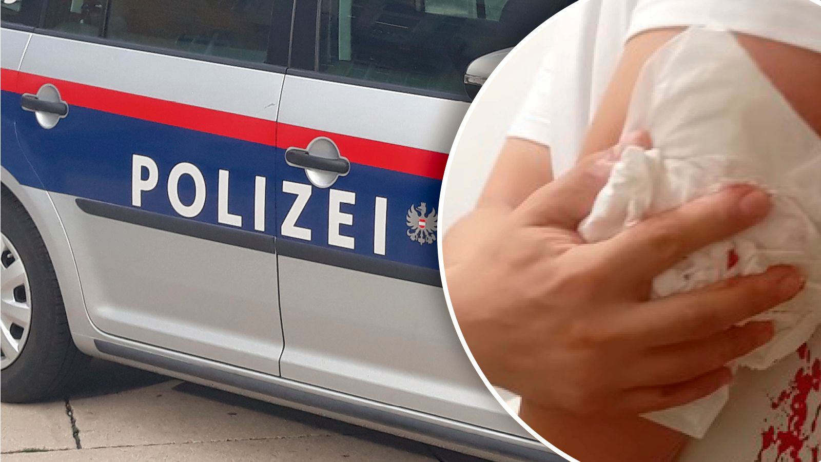 Messer-Attacke in Asylheim: Opfer am linken Oberarm verletzt