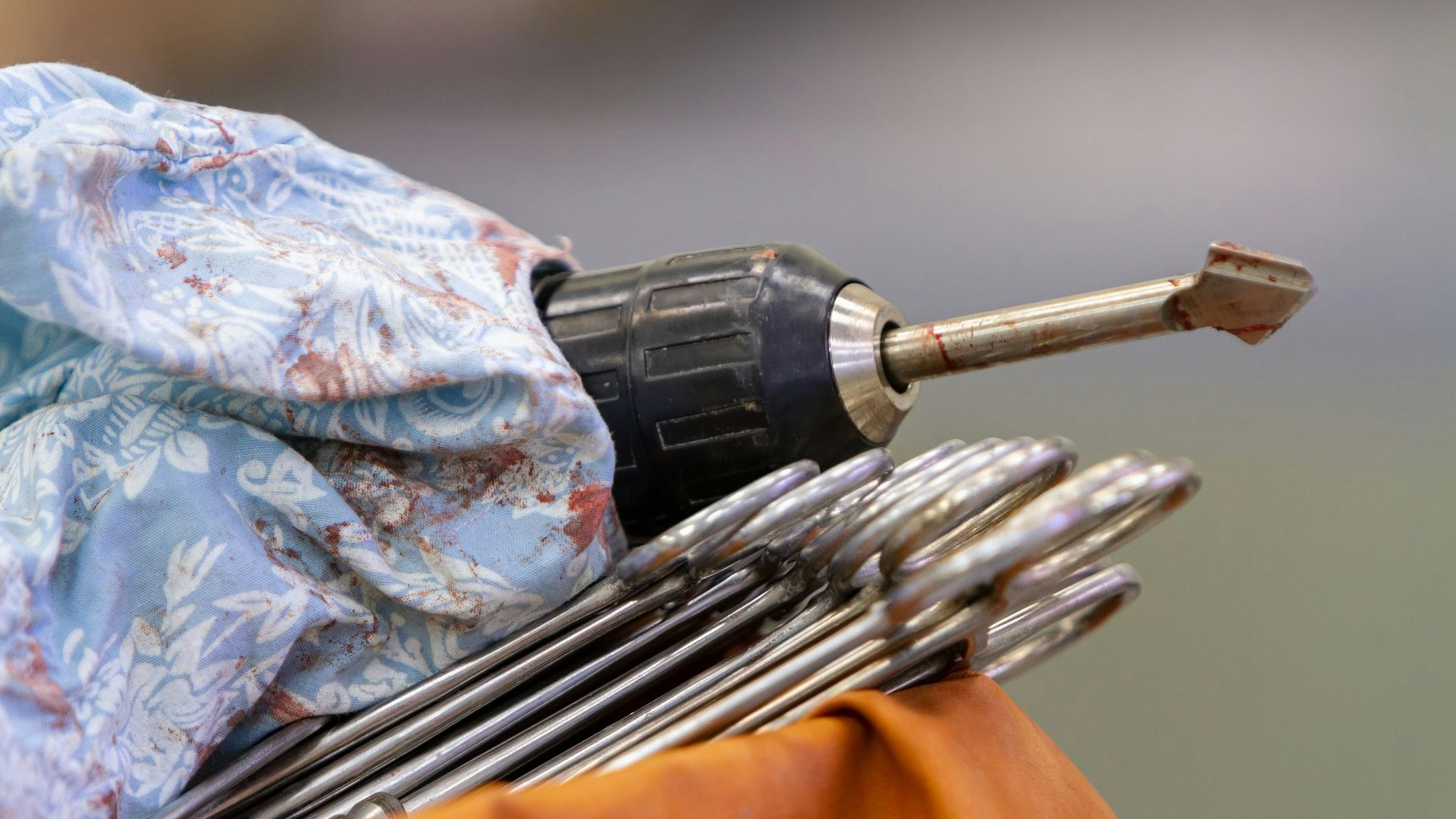 Heute.at - 13-Jährige bohrte bei Skandal-OP sogar den Schädel auf