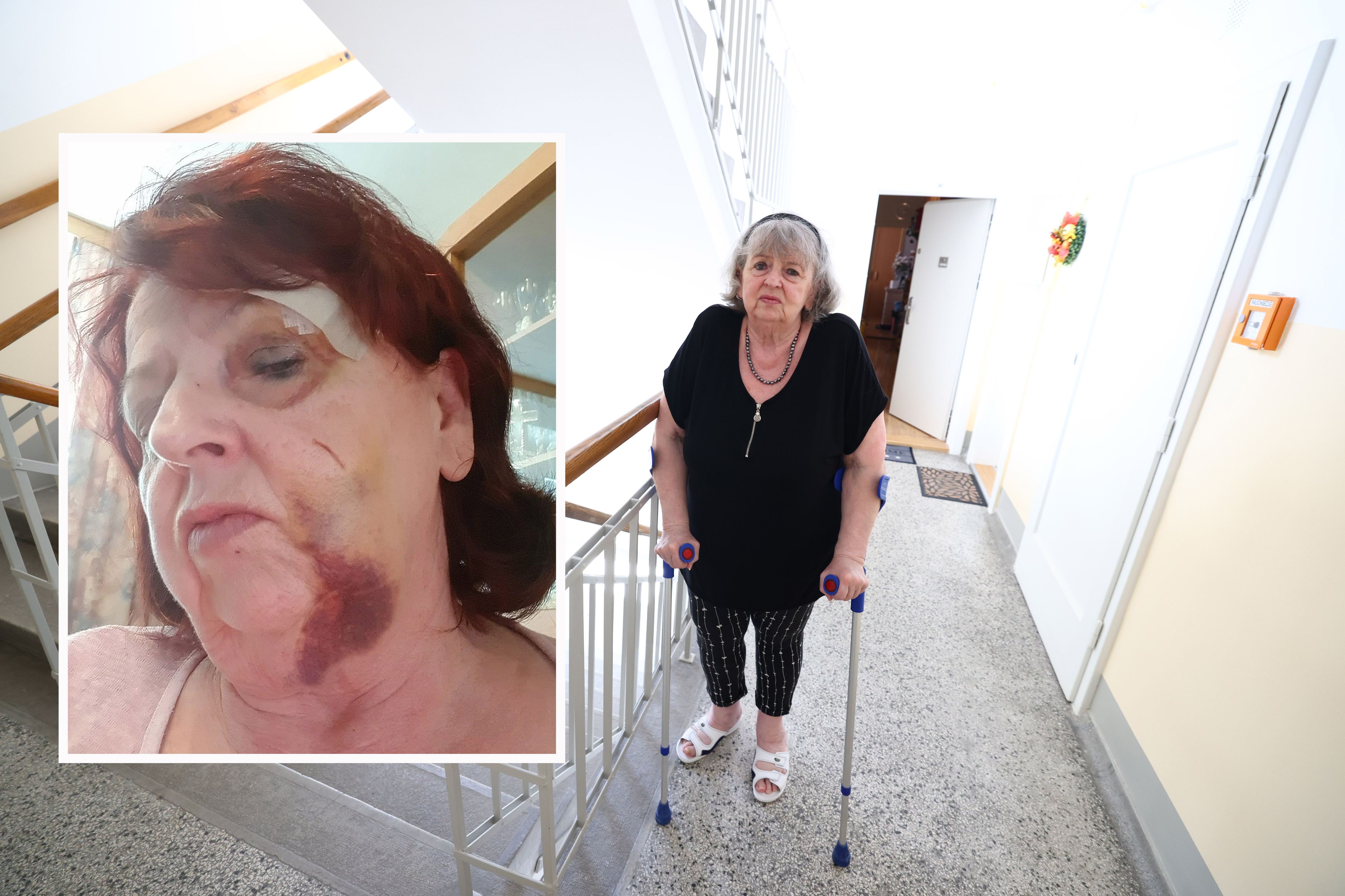 Hermine E. wurde bei dem Unfall durch den Waggon geschleudert, nun kann sie kaum noch gehen.