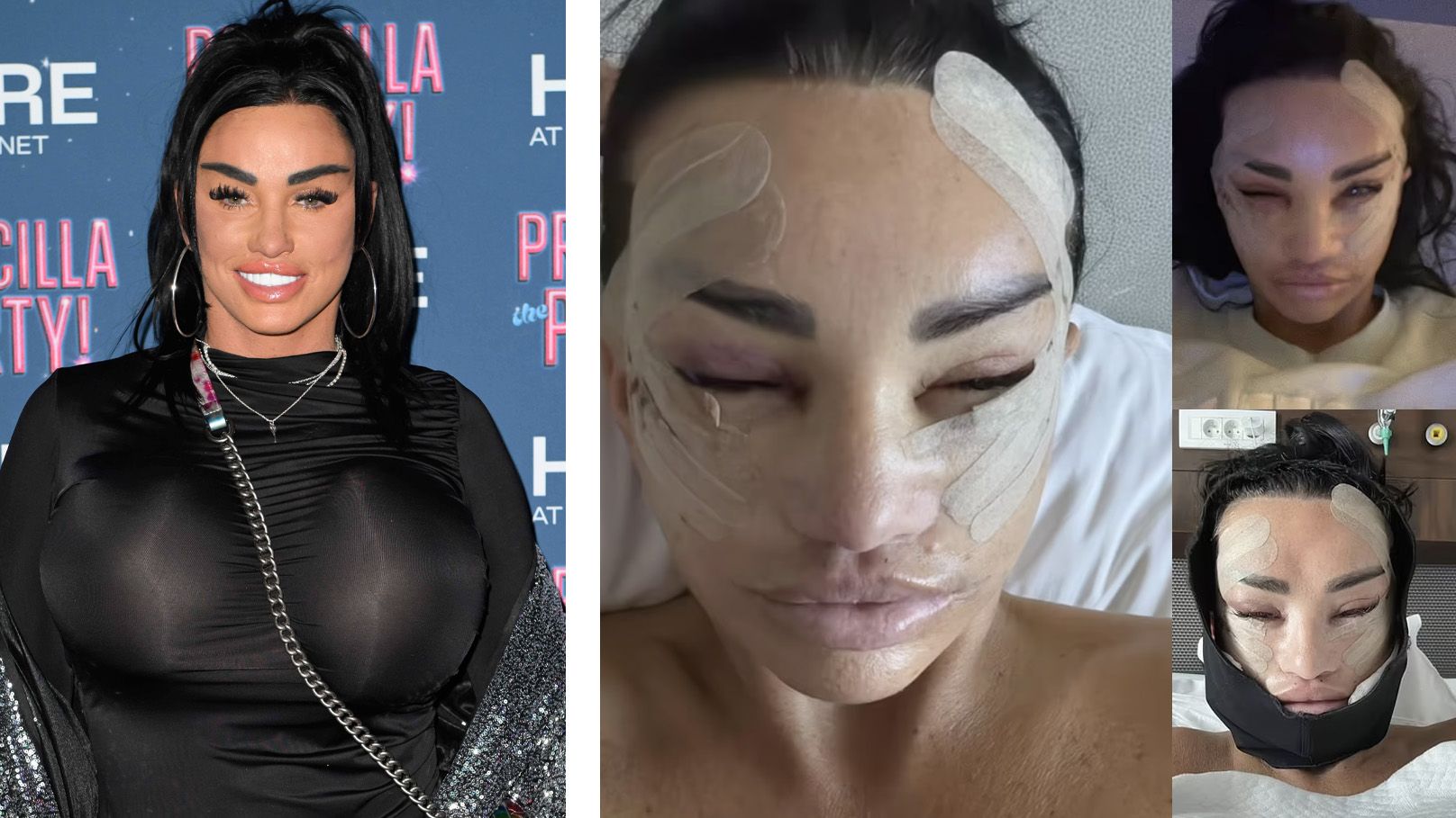 Katie Price lässt sich ständig 