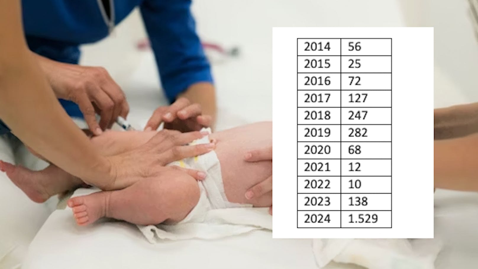 Keuchhustenfälle in NÖ: Heuer so viele Fälle (1.529) wie in den letzten zehn Jahren nicht