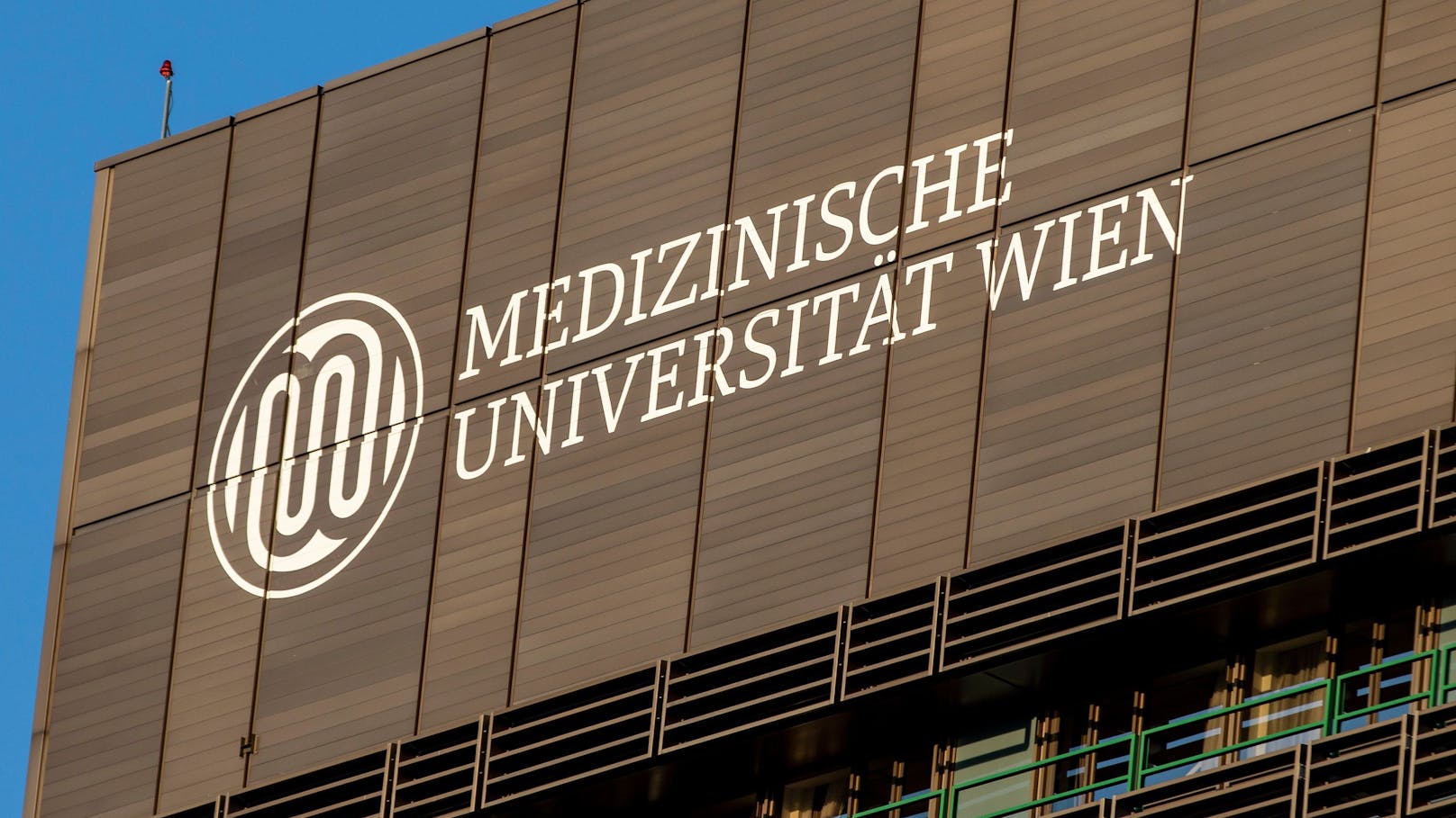 MedUni Wien bekommt Zentrum für Long Covid und ME/CFS